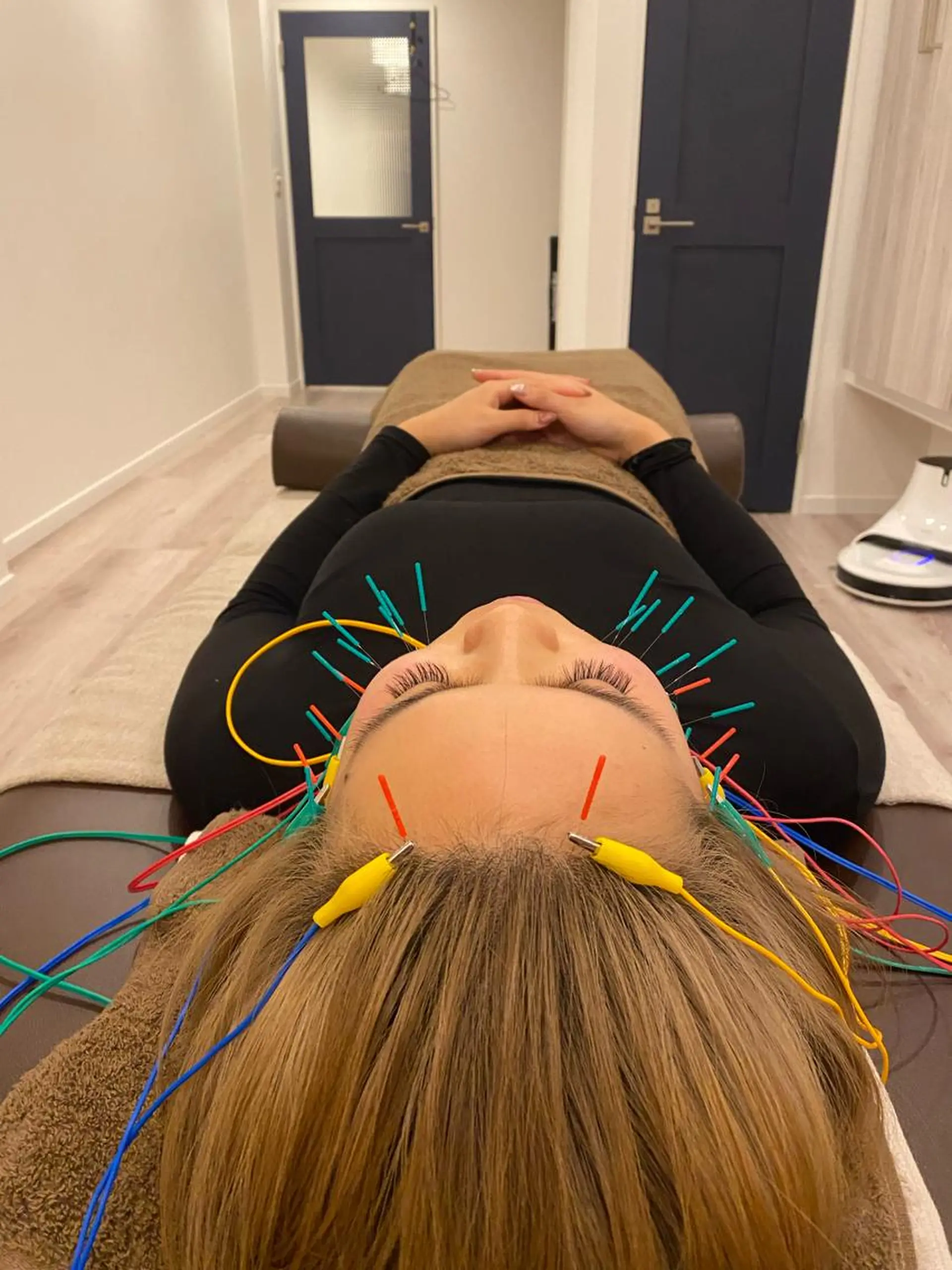 エステ リラク 肌質改善×美容鍼 ゆいのエステ・リラクイメージ