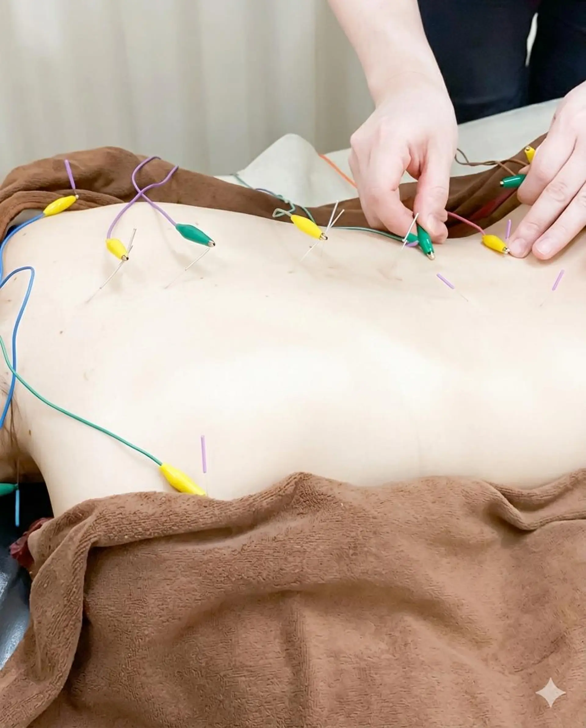 【美容鍼・小顔鍼】 鍼灸師　吉田洋美のエステ・リラクイメージ