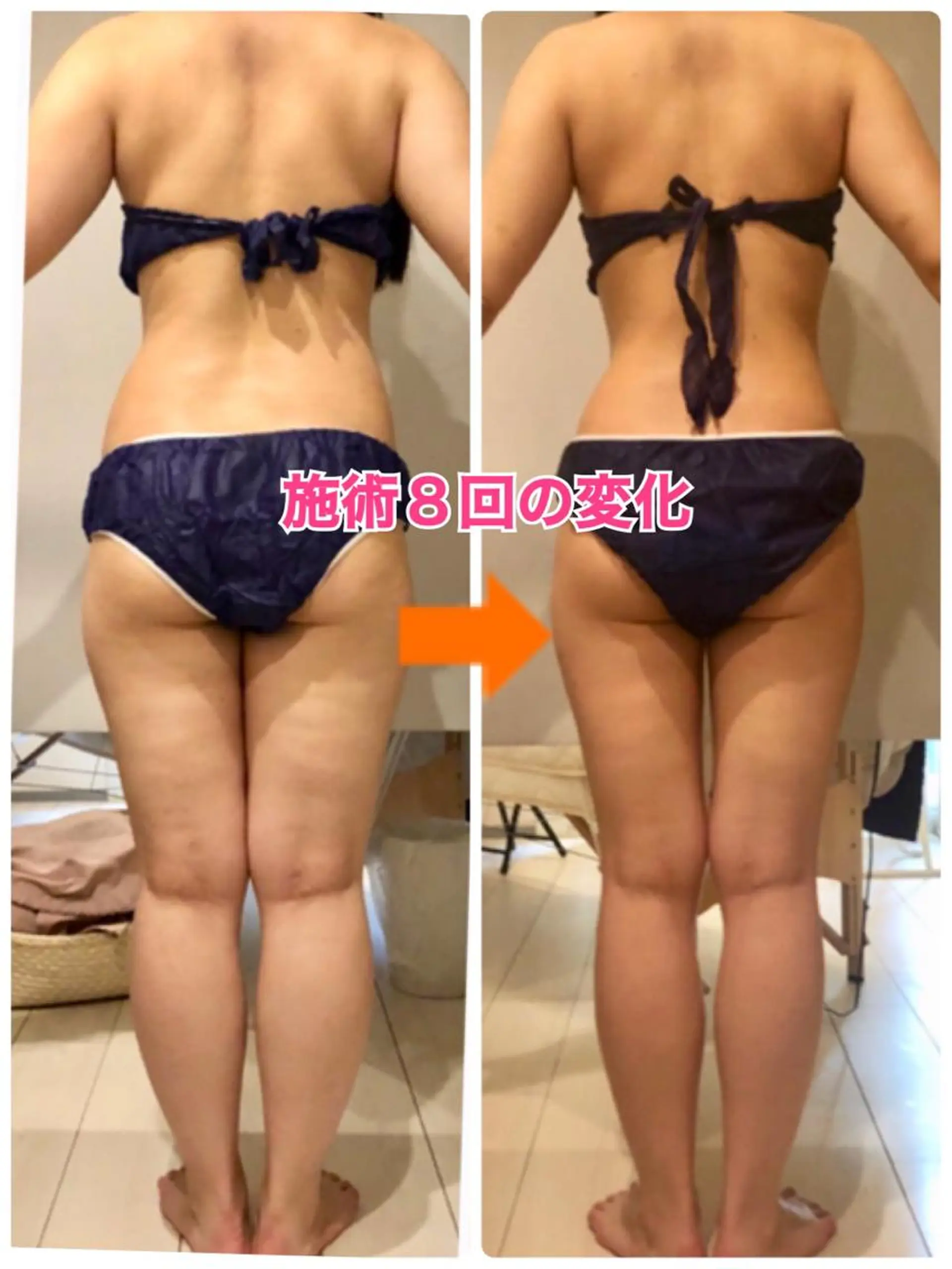 ロング カラー パーマ ヘアアレンジ メンズ キッズ ネイル マツエク・マツパ ‍痩身＆ボディ 結果出し🌟丹野のエステ・リラクイメージ