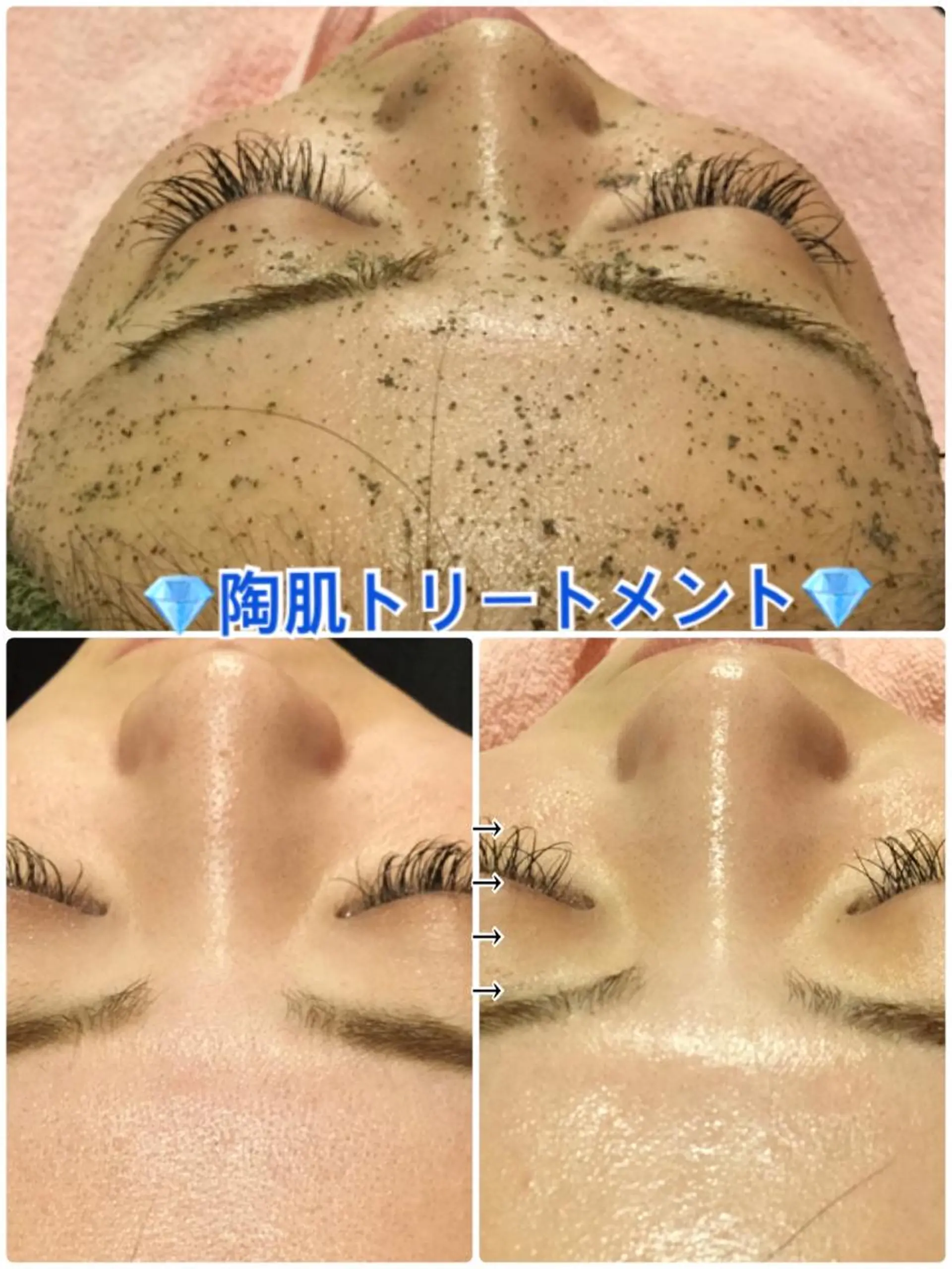 エステ Dione 立川店のエステ・リラクイメージ