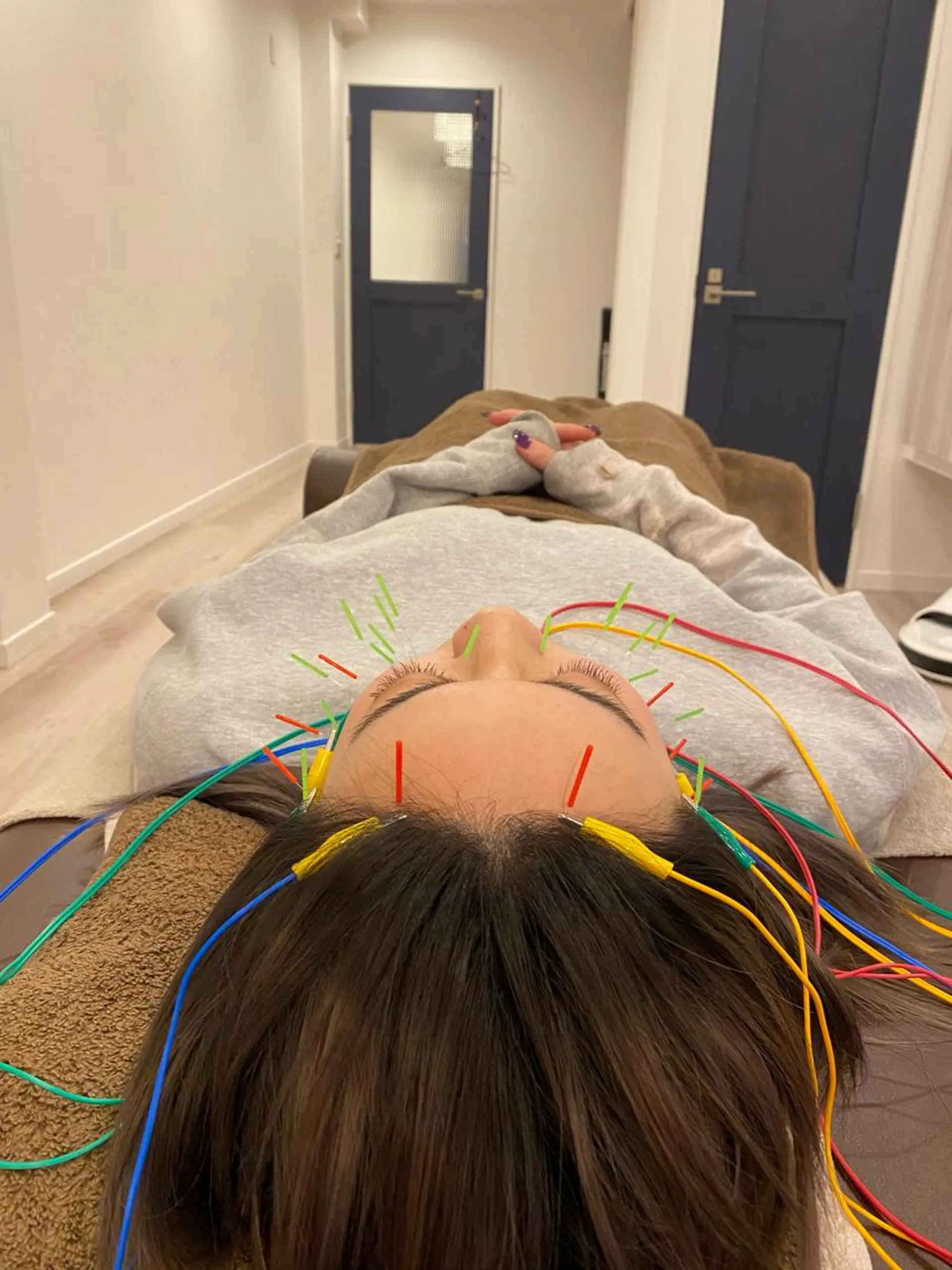 エステ リラク 肌質改善×美容鍼 ゆいのエステ・リラクイメージ