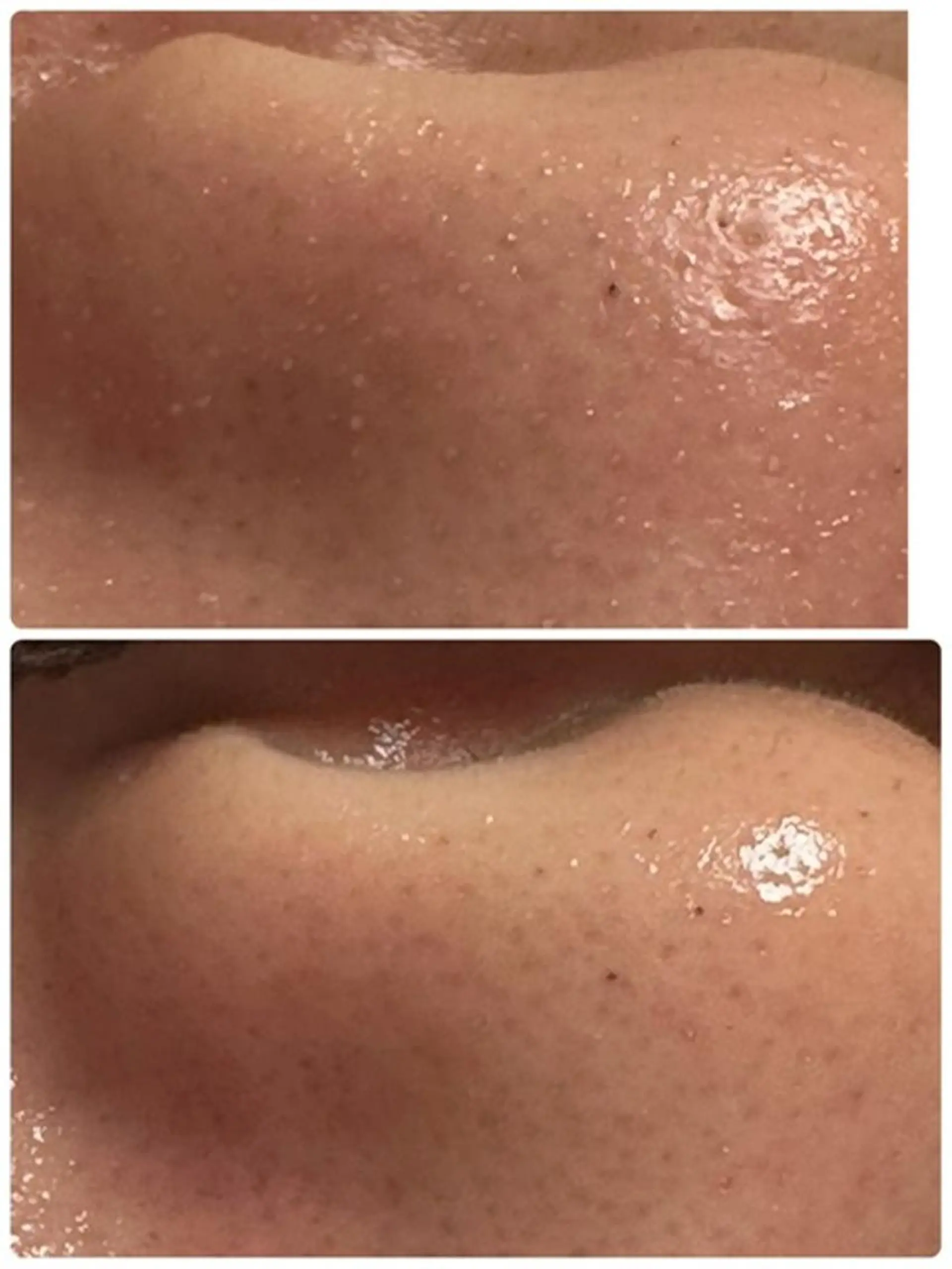 Lien オーナー　山口智嘉のエステ・リラクイメージ