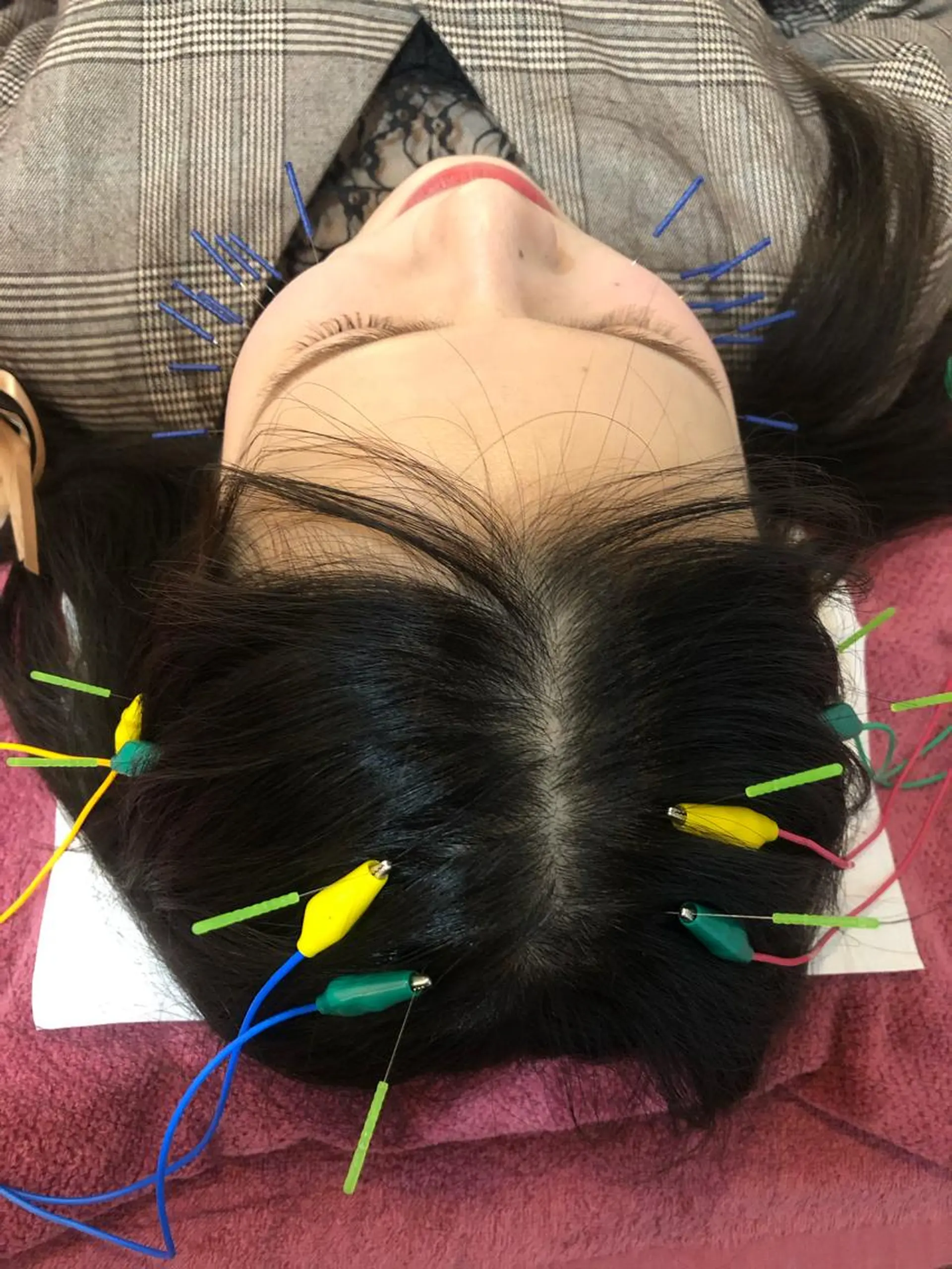 エステ リラク 美容鍼灸女性専用 りんご鍼灸治療院のその他イメージ