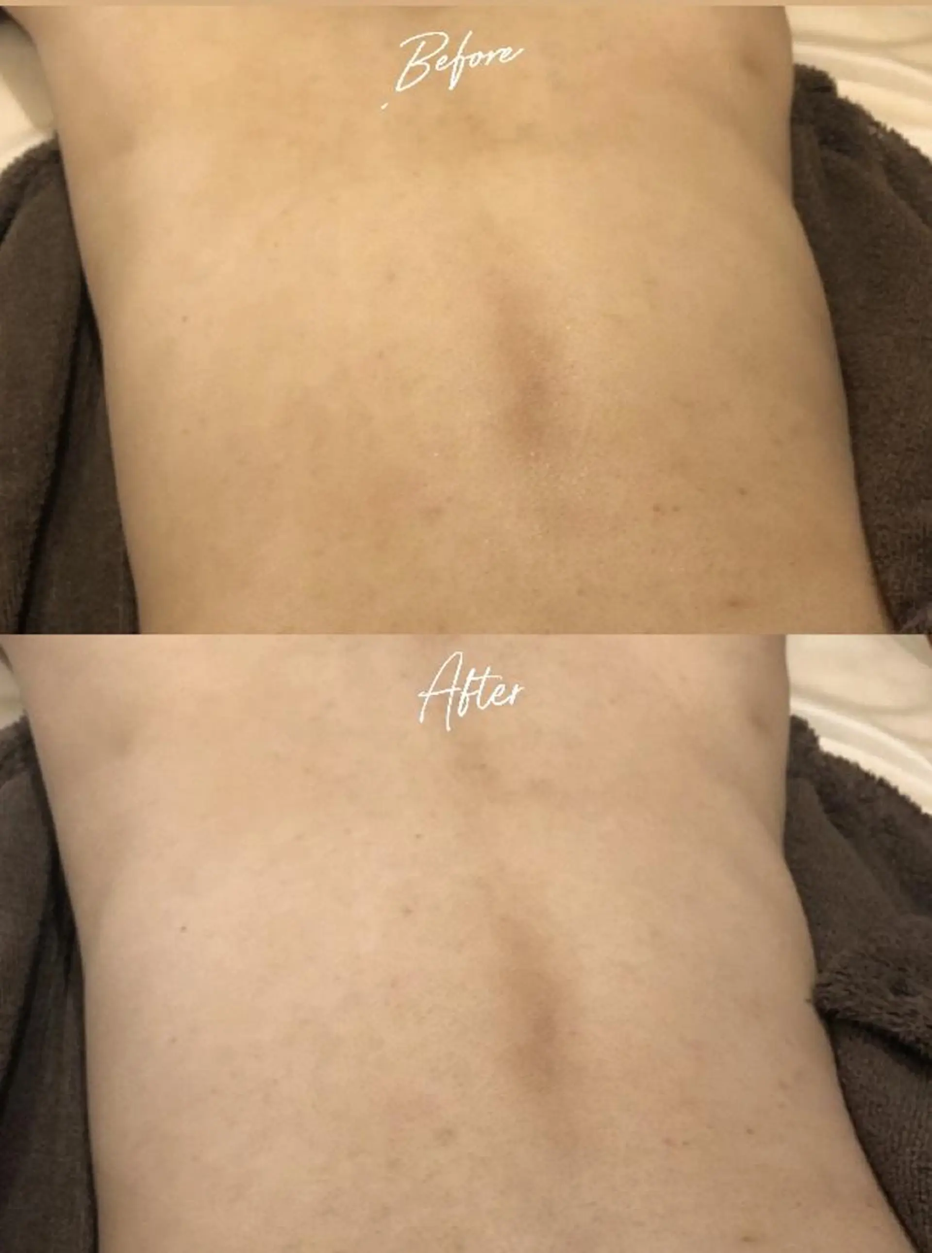 脱毛 美肌脱毛/肌質改善 《ulula～梟》のエステ・リラクイメージ