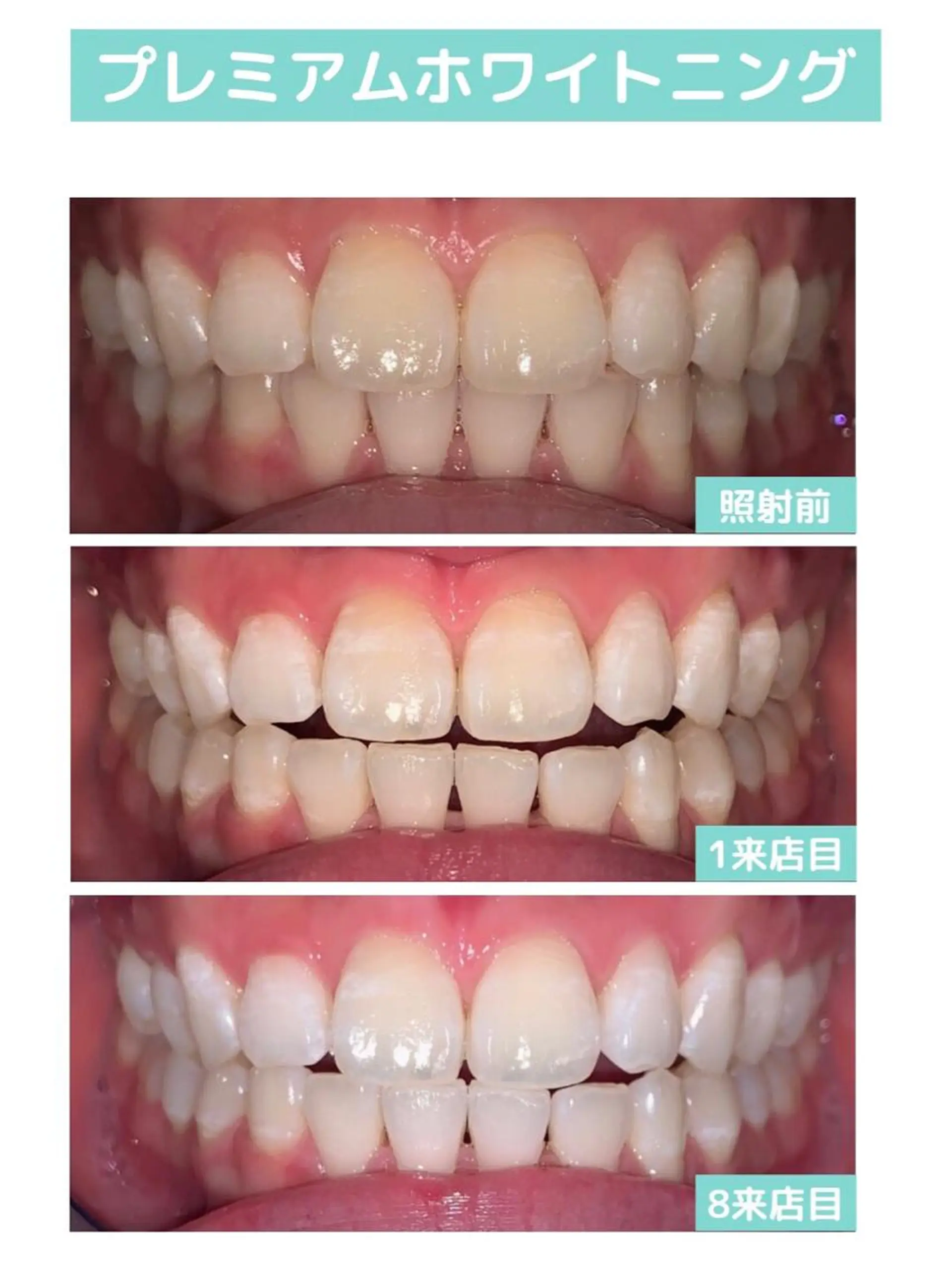 その他 韓国式3D毛穴洗浄 lonhanaのその他イメージ