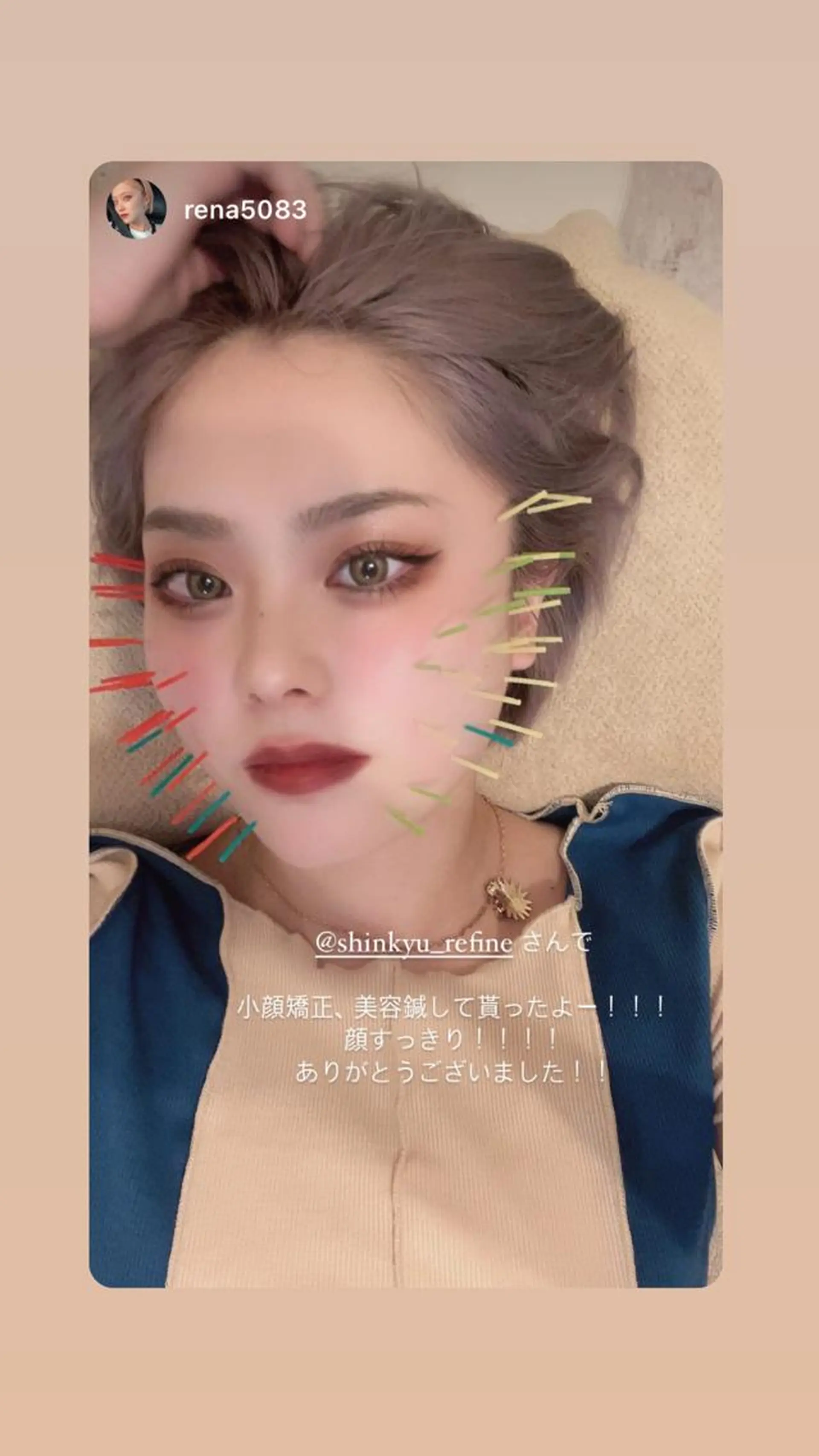 鍼灸 Refineのその他イメージ