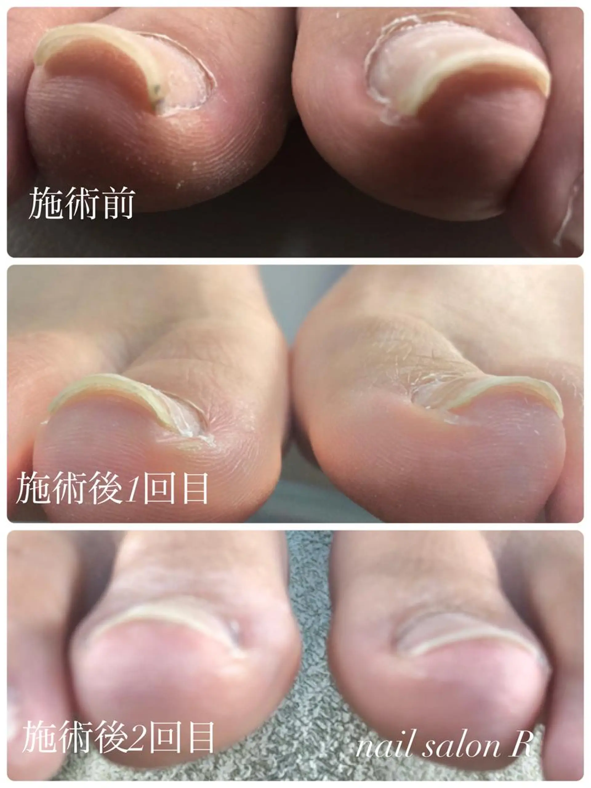 ネイル nail salon Rのネイルデザイン