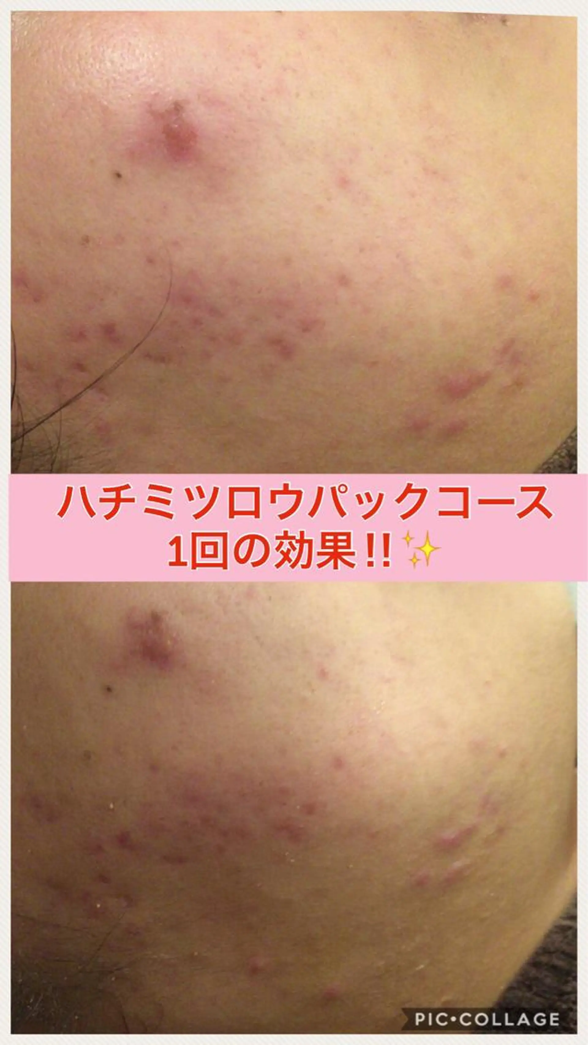 ショート カラー ヘアアレンジ メンズ キッズ ネイル マツエク・マツパ 赤色 ニキビ・肌質改善専門 ♡人生が変わるサロンのエステ・リラクイメージ