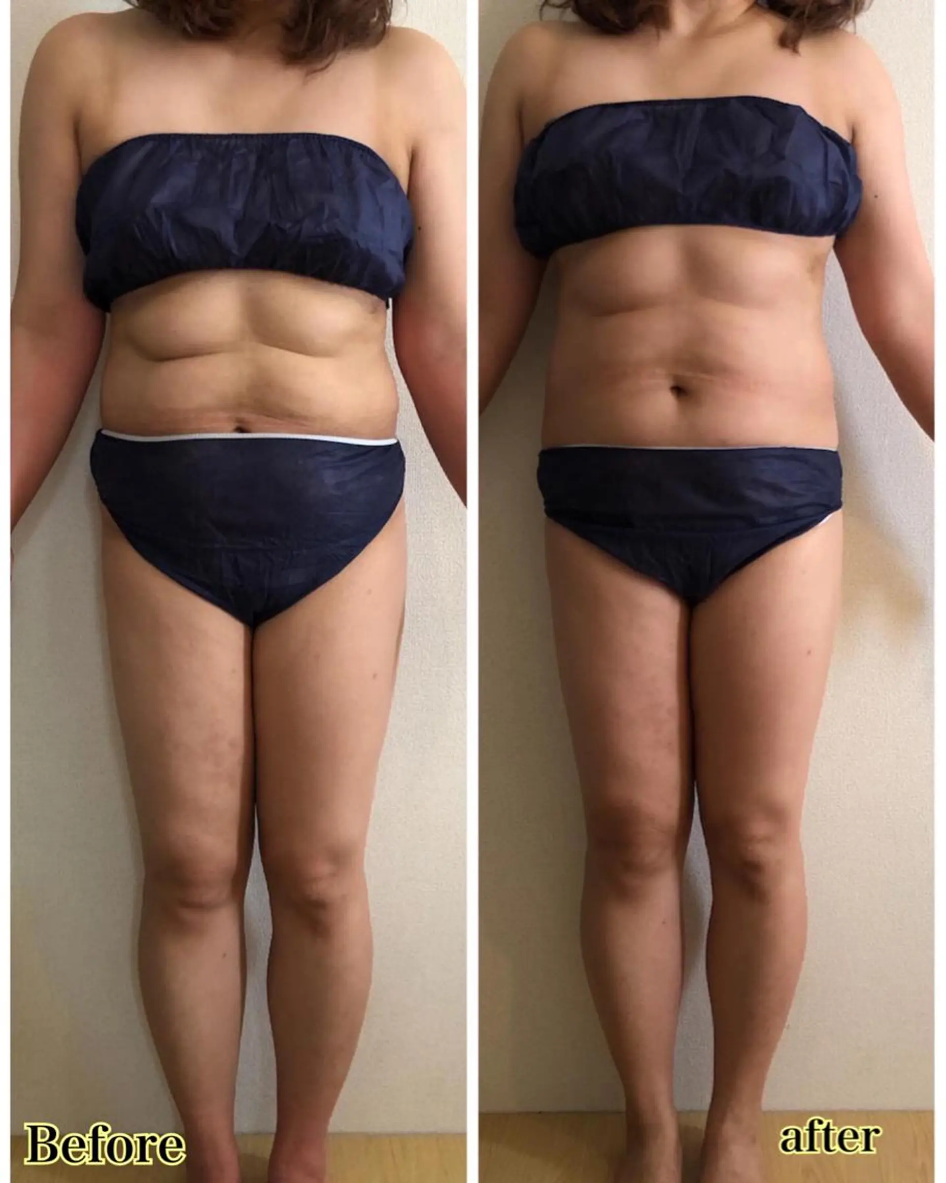 ❤︎MN❤︎ モンのエステ・リラクイメージ