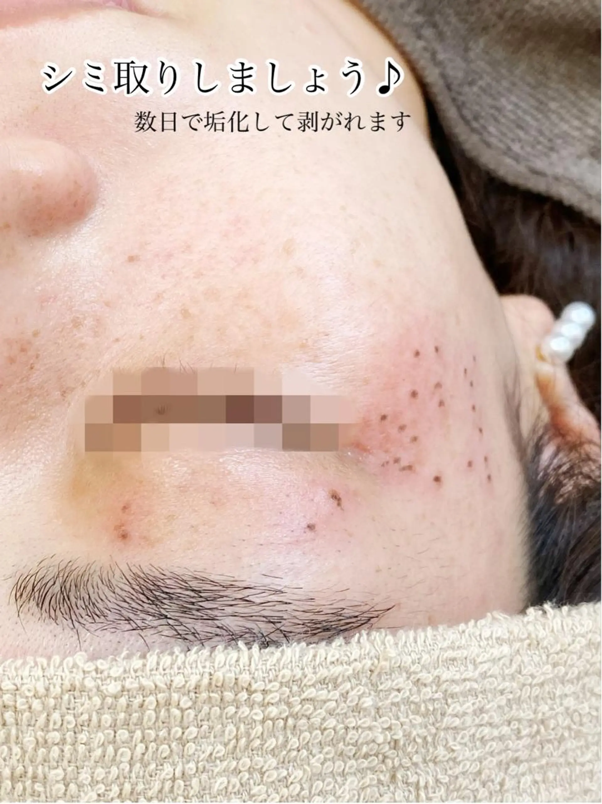 Ailes トータルビューティーのエステ・リラクイメージ