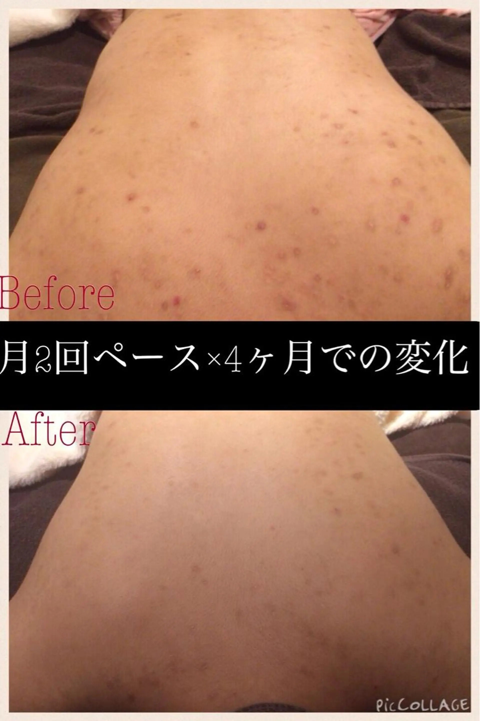 ミディアム カラー パーマ ヘアアレンジ メンズ キッズ ネイル マツエク・マツパ エステ リラク ニキビ・肌質改善専門 ♡人生が変わるサロンのエステ・リラクイメージ