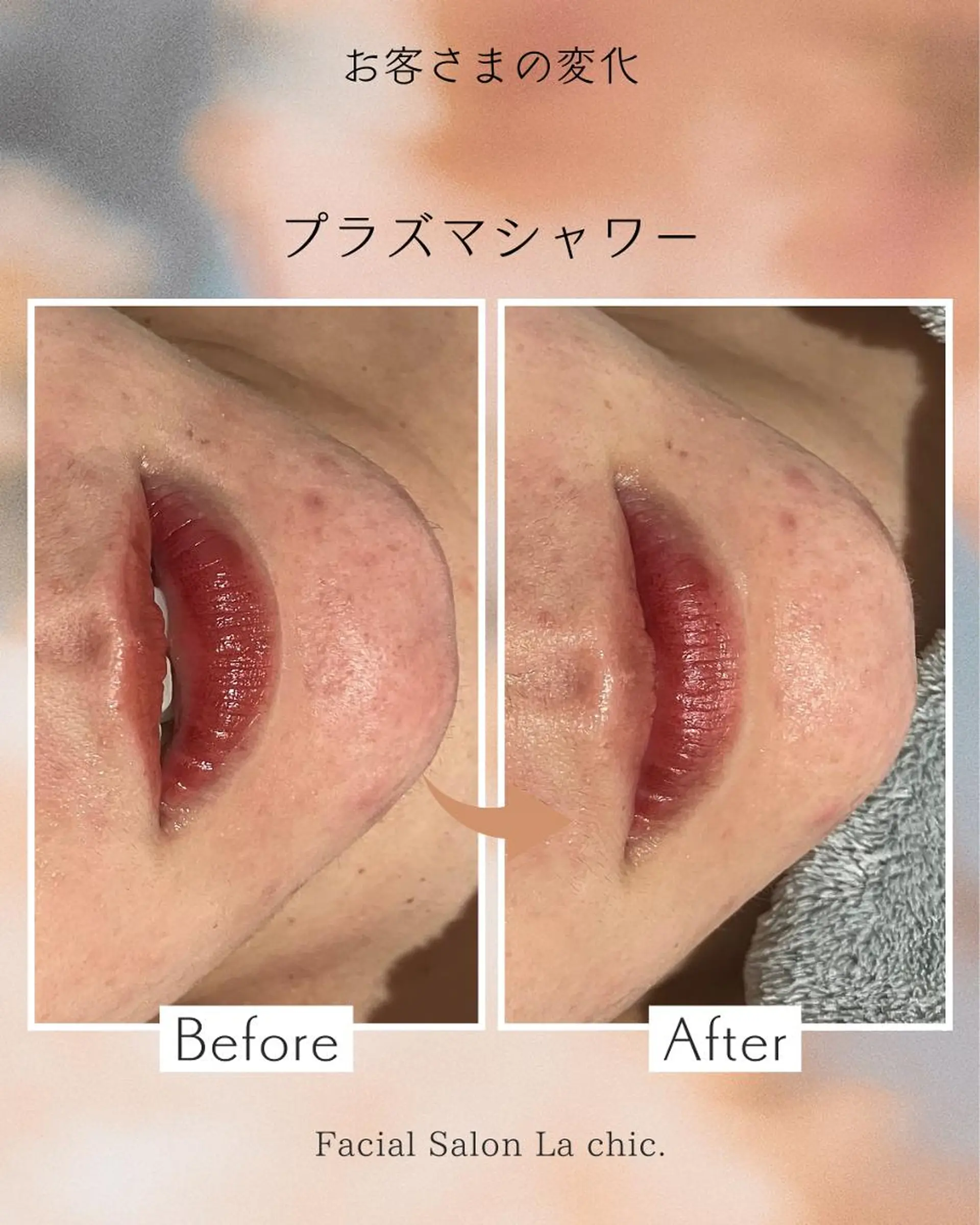 La chic.のエステ・リラクイメージ