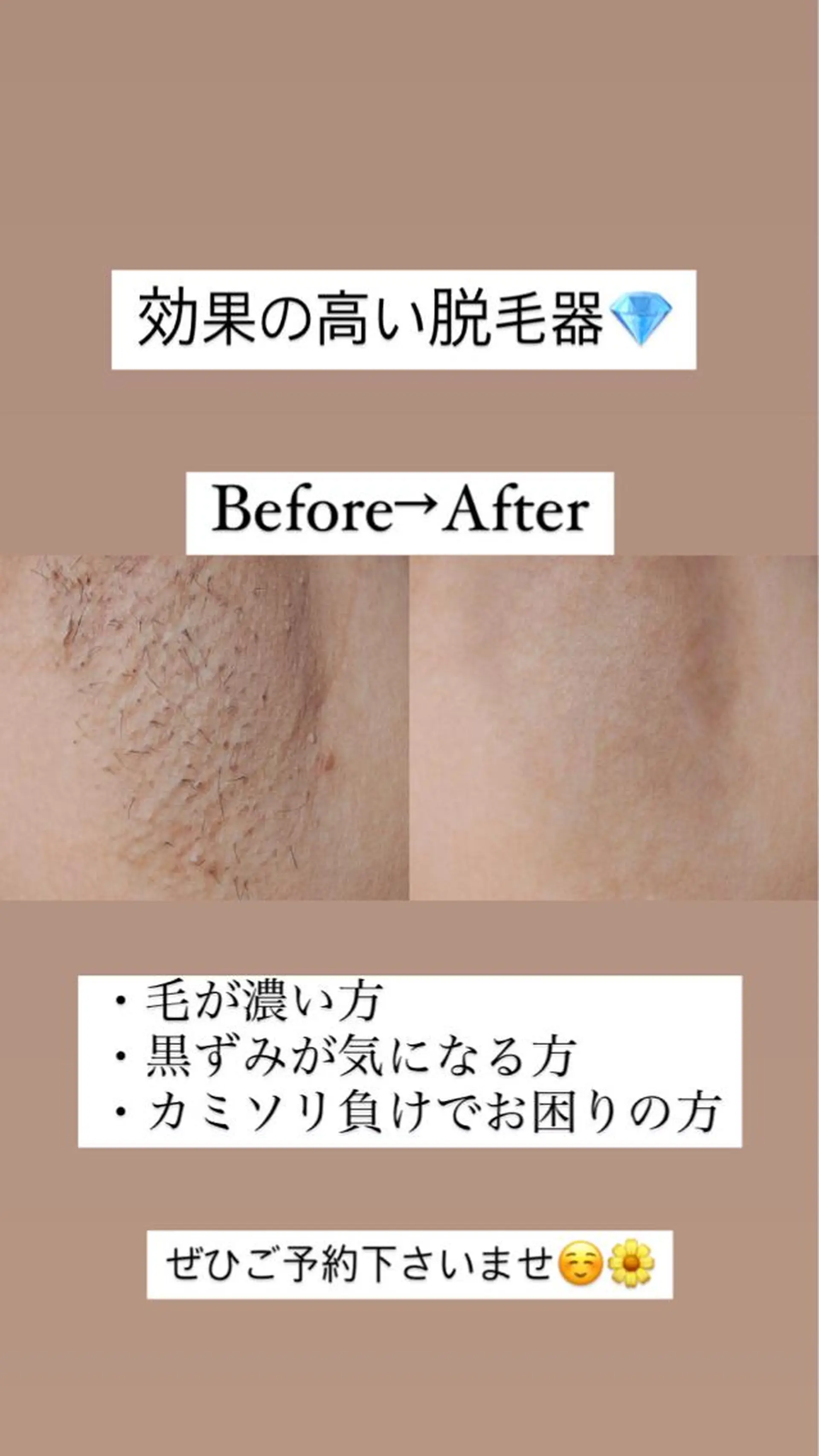 ロング カラー パーマ ヘアアレンジ メンズ キッズ ネイル マツエク・マツパ アイブロウ Chloe-クロエ- 脱毛/フェイシャルのエステ・リラクイメージ