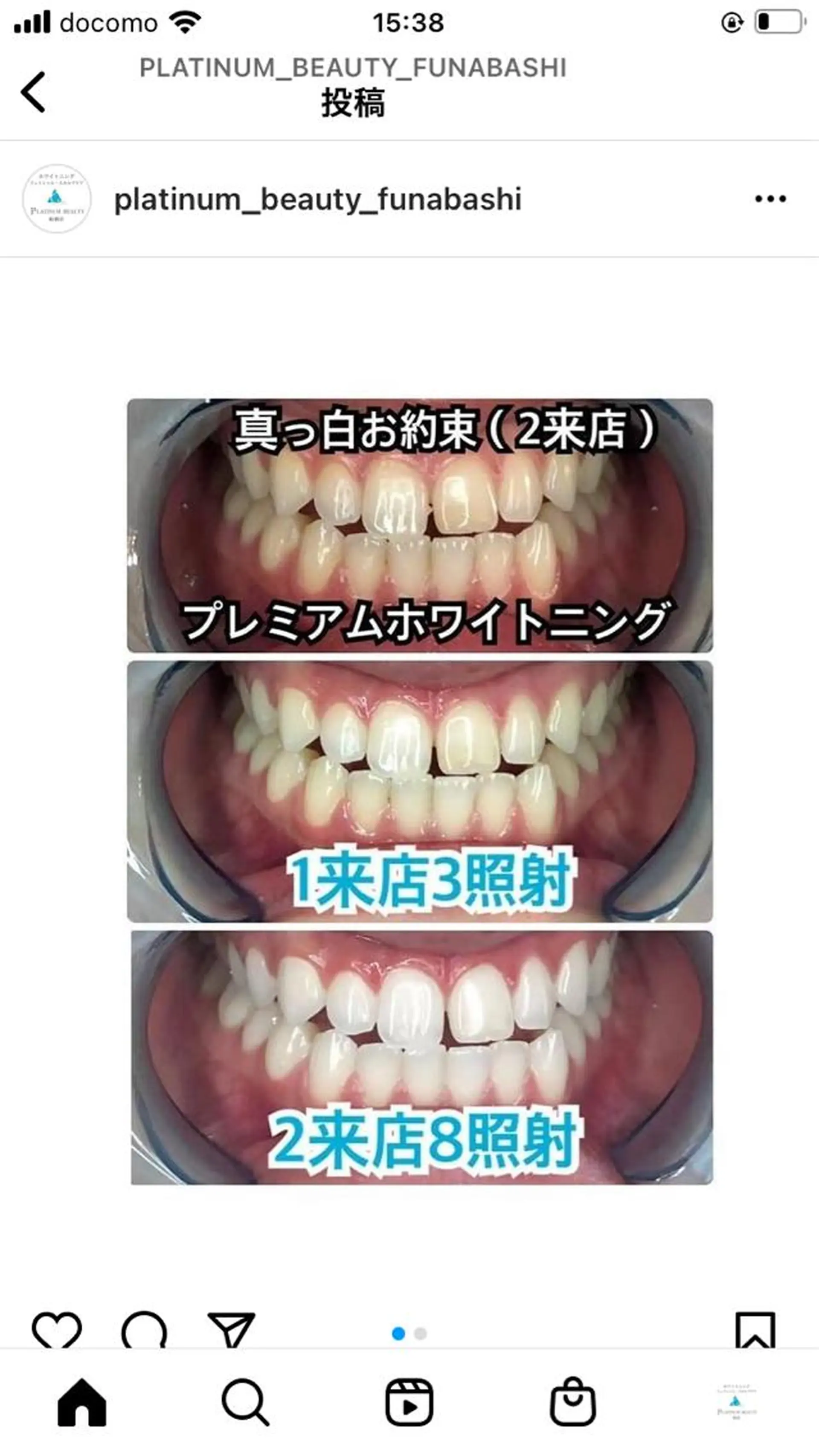 セミロング カラー パーマ ヘアアレンジ キッズ ネイル マツエク・マツパ アイブロウ 【歯科提携】柏ホワイ トニングスタイルのその他イメージ