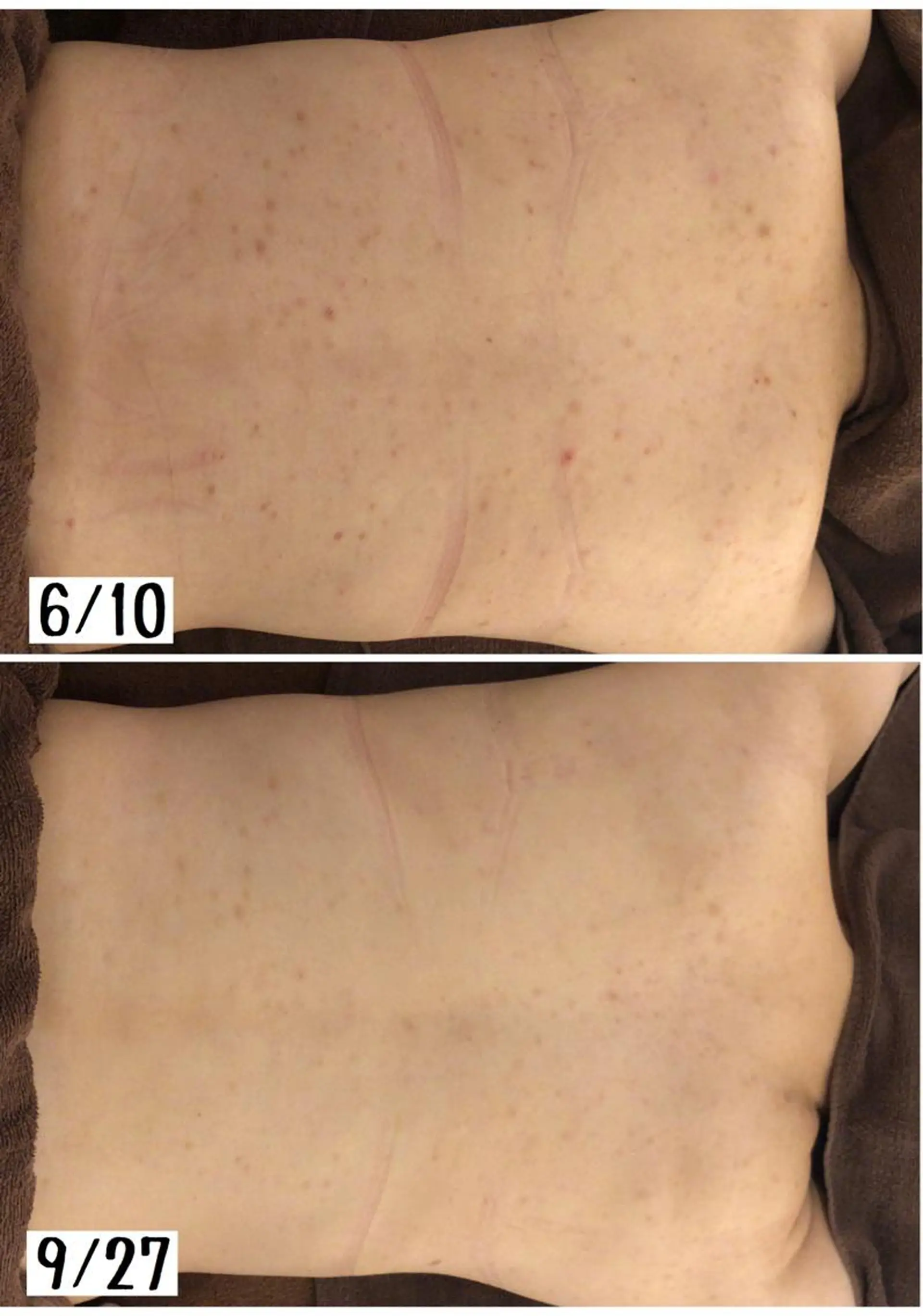 ミディアム カラー パーマ ヘアアレンジ メンズ キッズ ネイル マツエク・マツパ エステ リラク ニキビ・肌質改善専門 ♡人生が変わるサロンのエステ・リラクイメージ