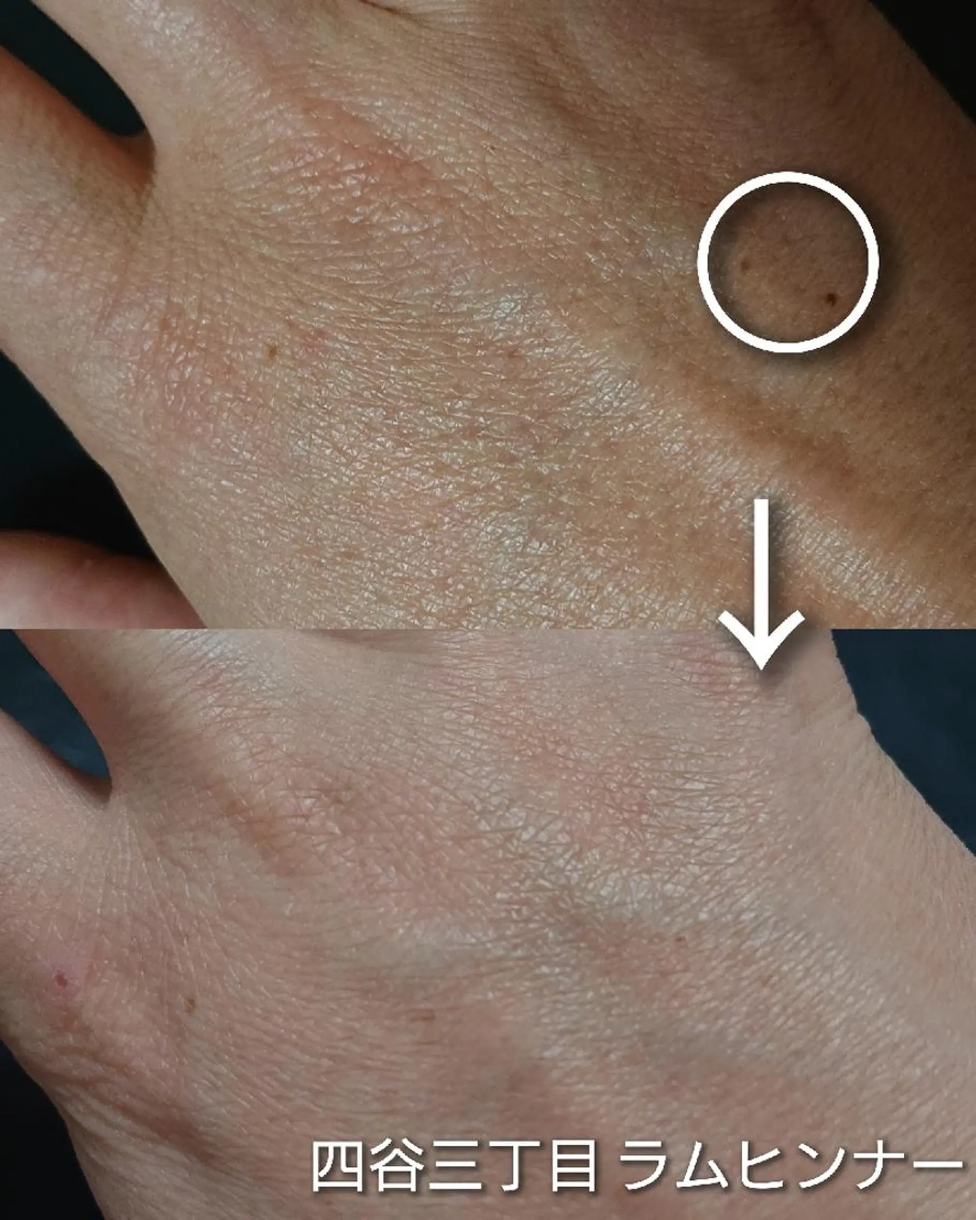 Rum Hinna ラムヒンナーのその他イメージ