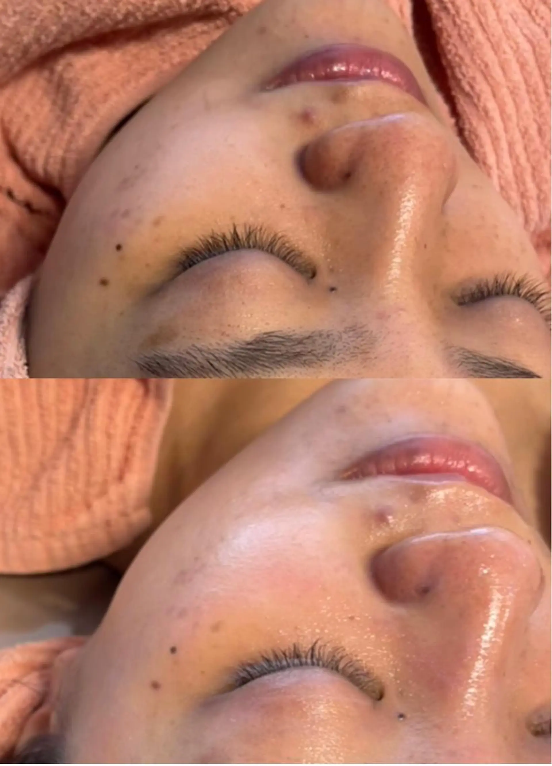 エステ 女性のお悩み美容 サロン ヴィーナスのエステ・リラクイメージ