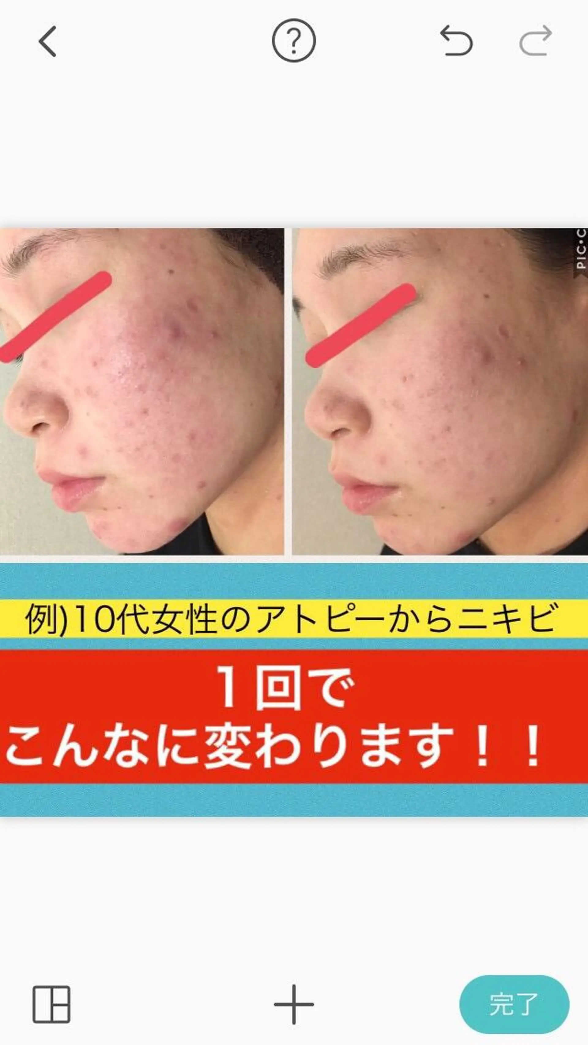 ショート カラー パーマ ヘアアレンジ メンズ キッズ ネイル マツエク・マツパ ニキビ・肌質改善専門 ♡人生が変わるサロンのエステ・リラクイメージ