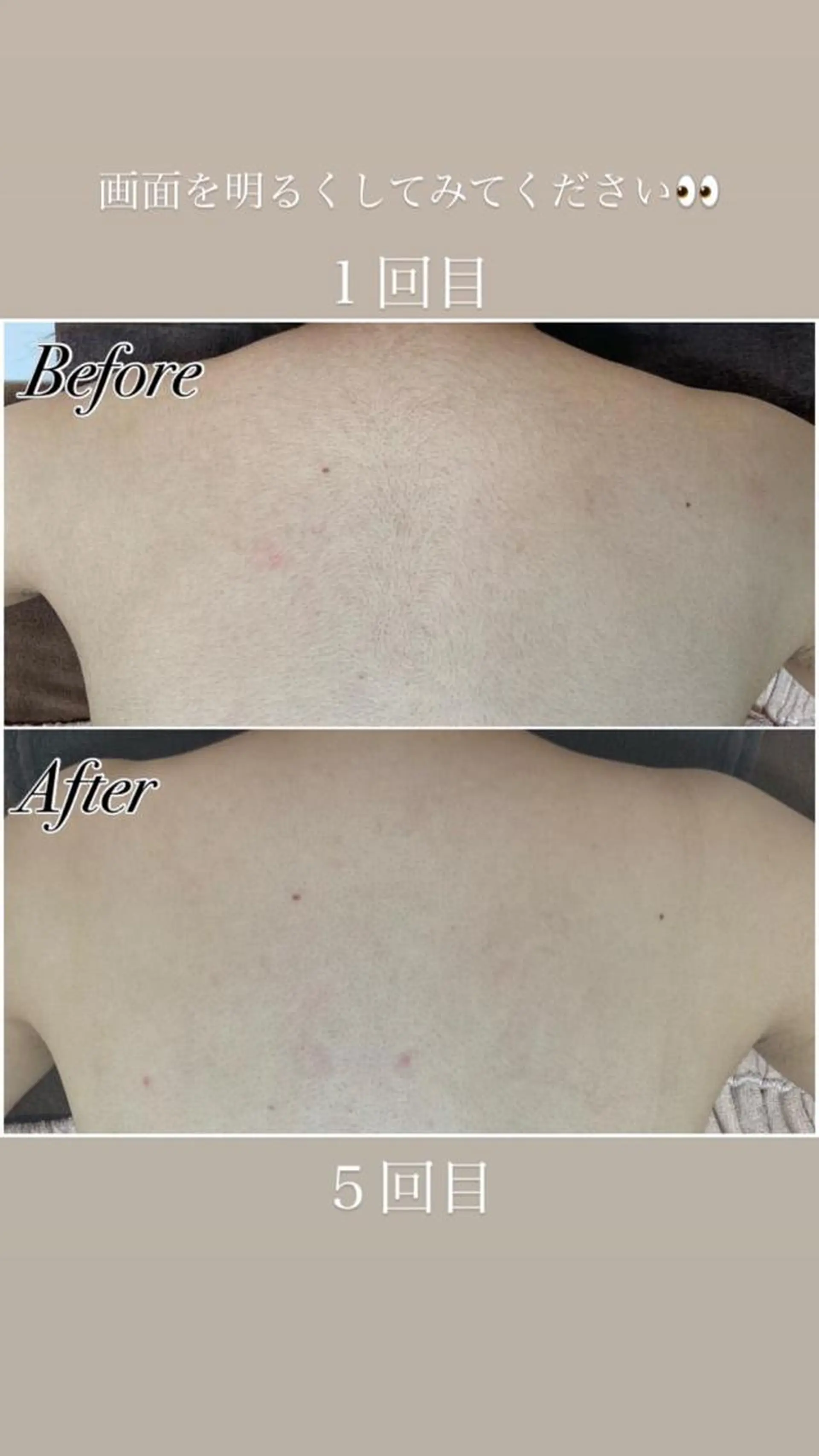 Be Charm 山﨑のエステ・リラクイメージ