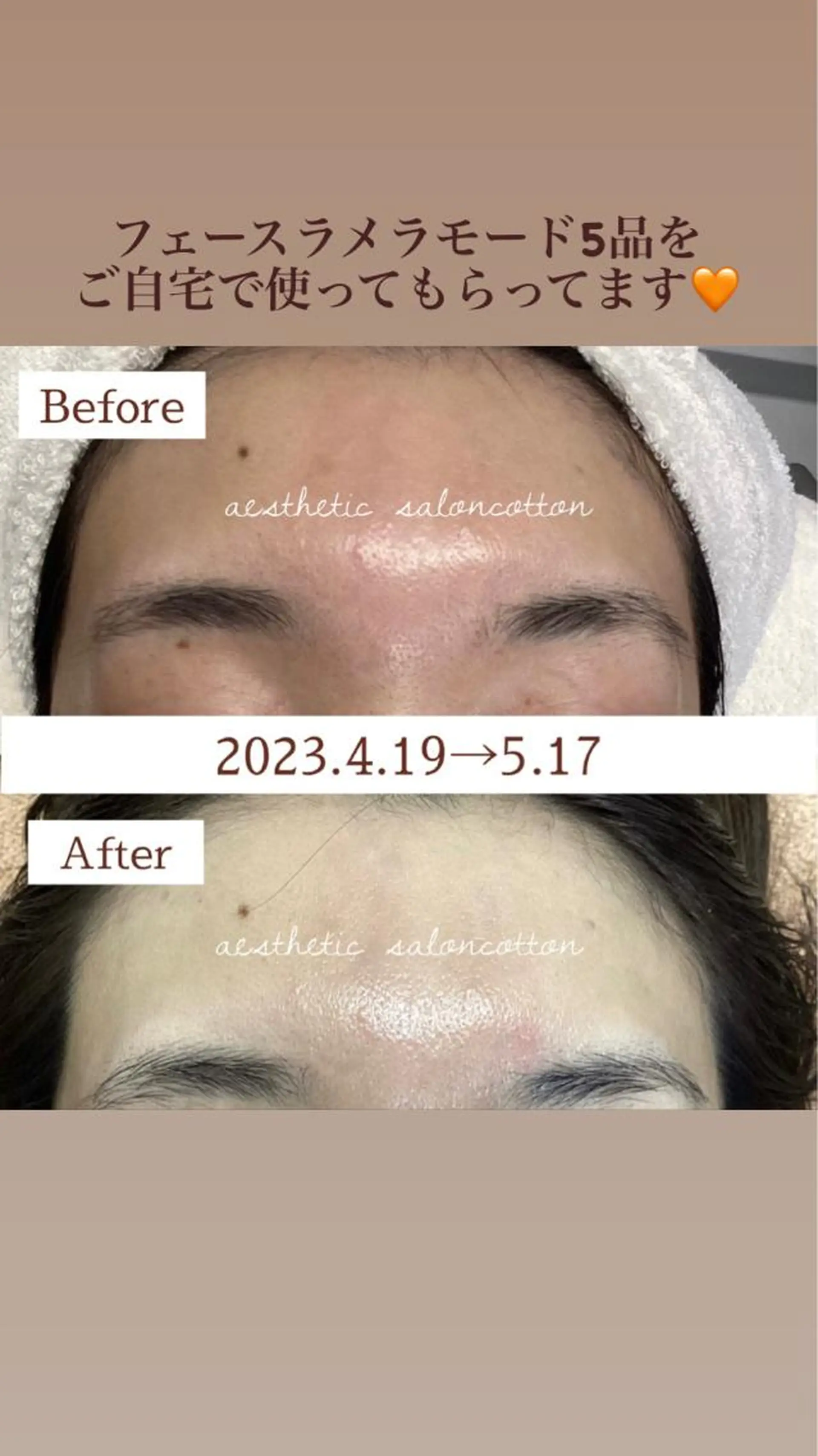 エステ 都度払い 肌質改善専門サロンのエステ・リラクイメージ