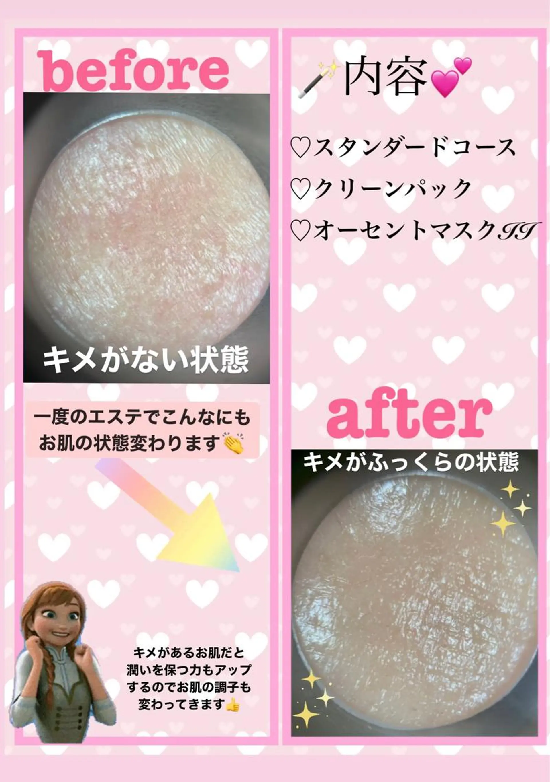 肌質改善サロン 来店プレゼントありのエステ・リラクイメージ