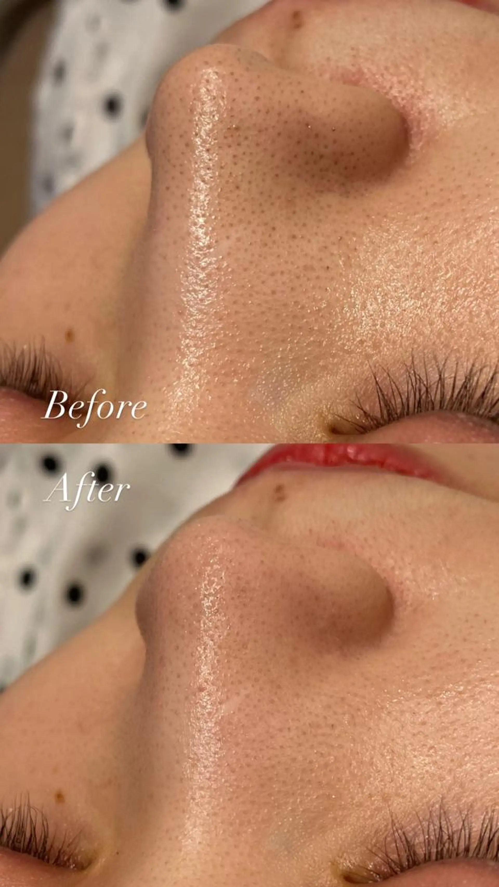 Lilyboo 多田のエステ・リラクイメージ