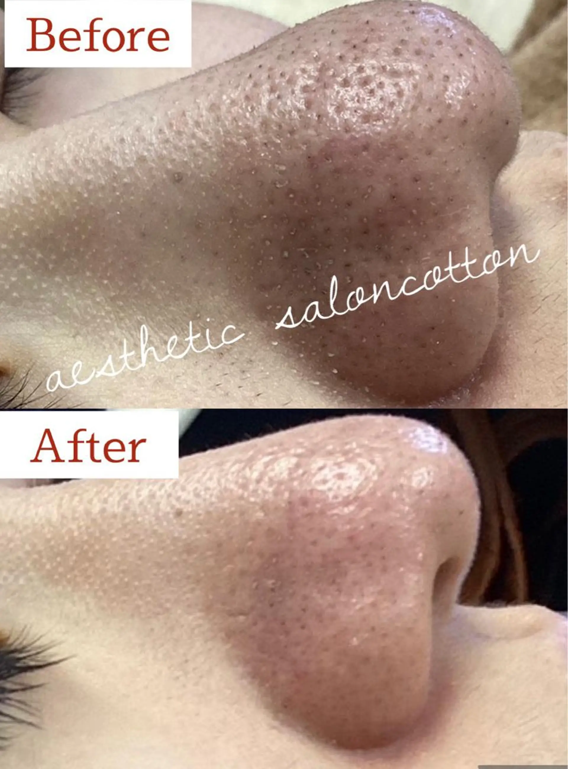 エステ 都度払い 肌質改善専門サロンのエステ・リラクイメージ