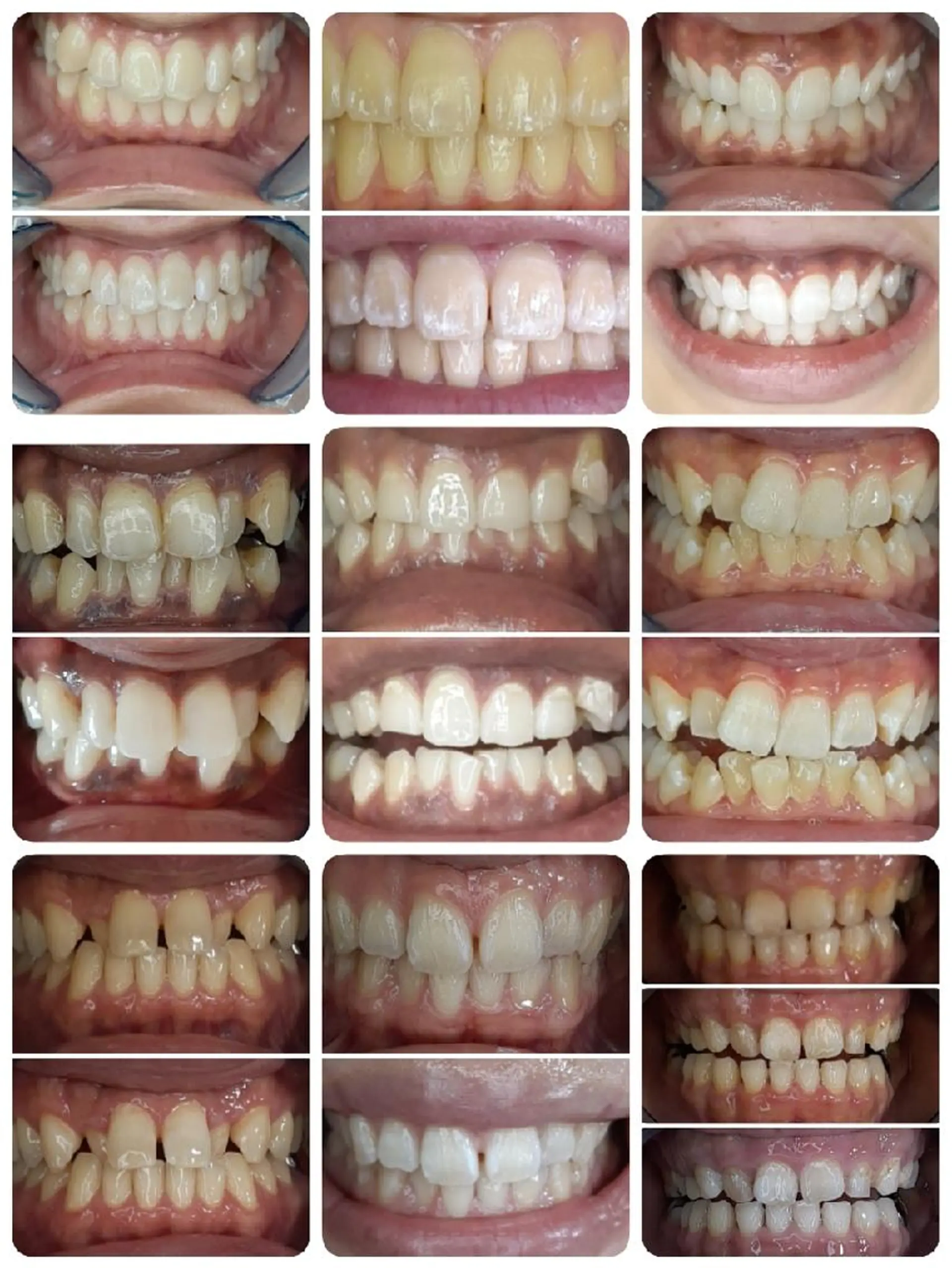 五十嵐 蓮のその他イメージ