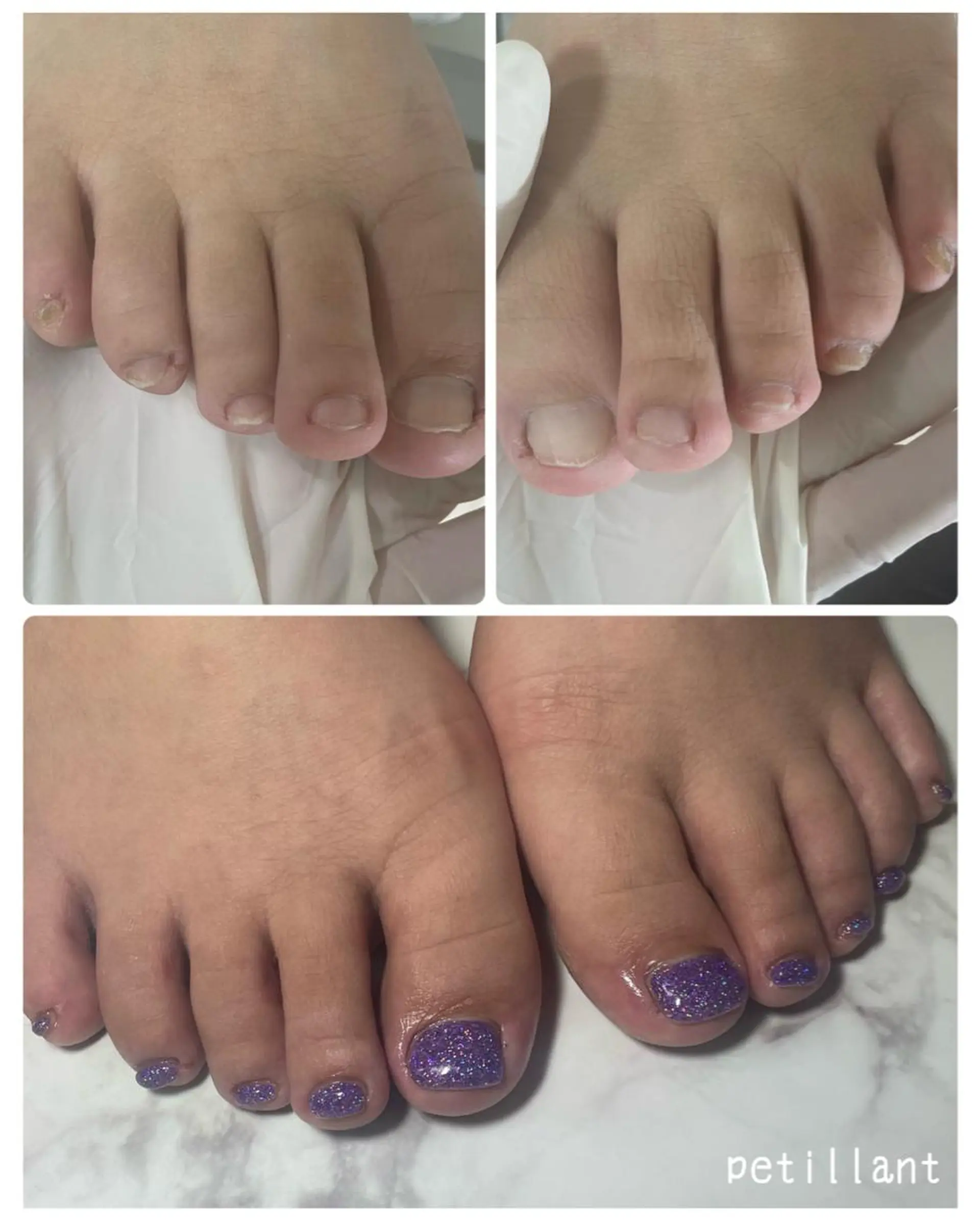 ネイル 長さ出し フットネイル nail salon petillantのネイルデザイン