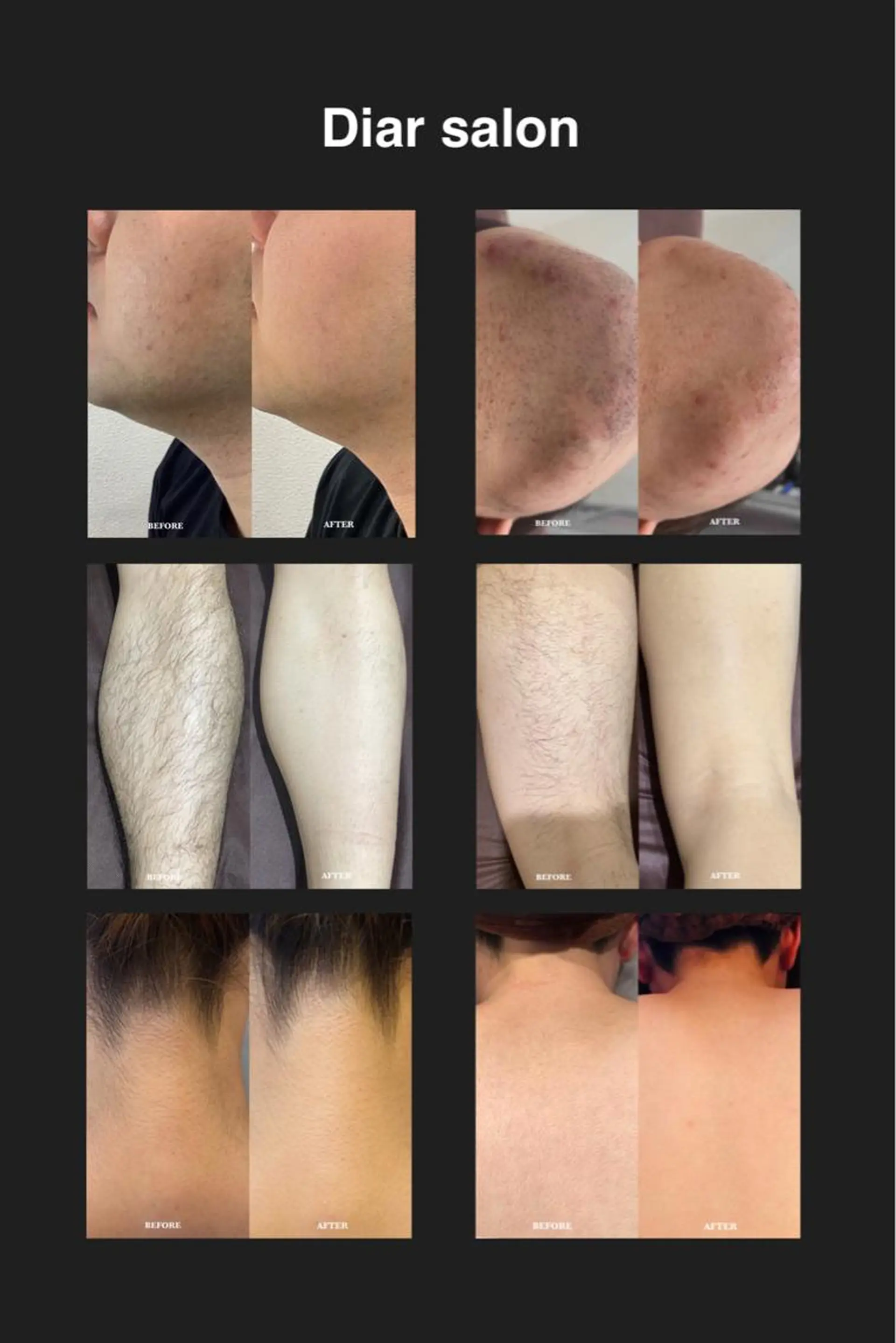 脱毛 Diar salonのその他イメージ