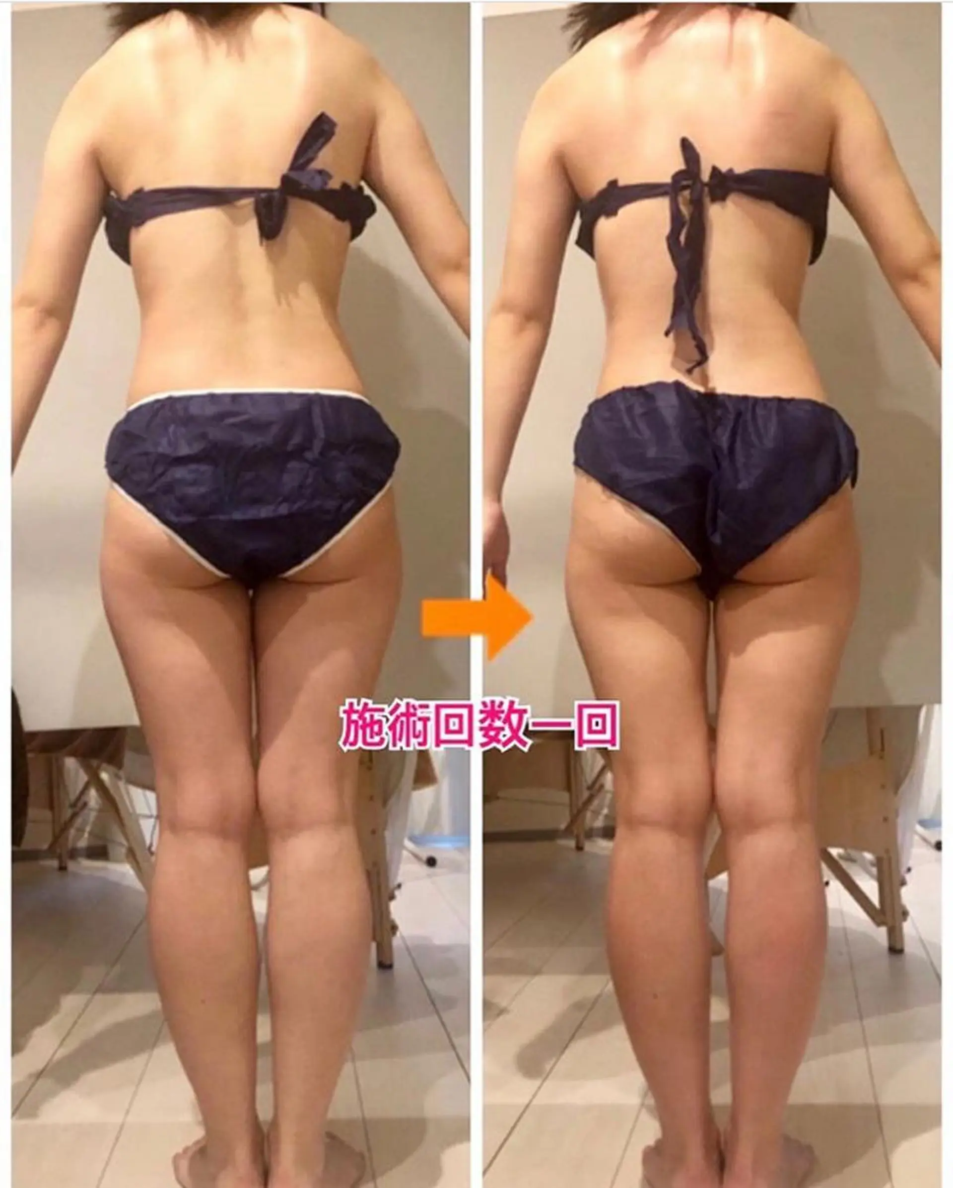 ロング カラー パーマ ヘアアレンジ メンズ キッズ ネイル マツエク・マツパ 痩身&ボディ 結果出し🌟丹野のエステ・リラクイメージ