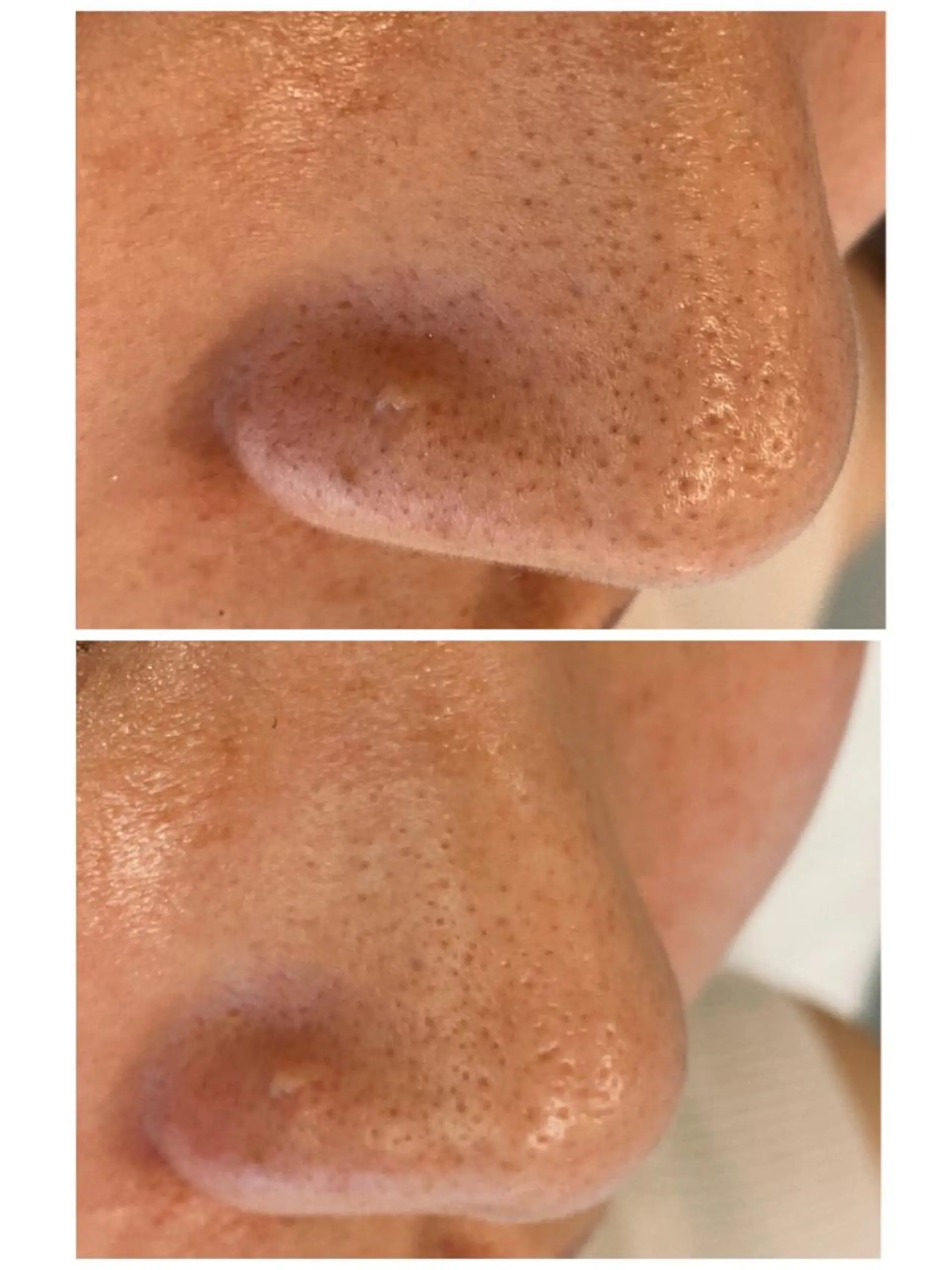 エステ リラク Porte beauteオーナーのエステ・リラクイメージ