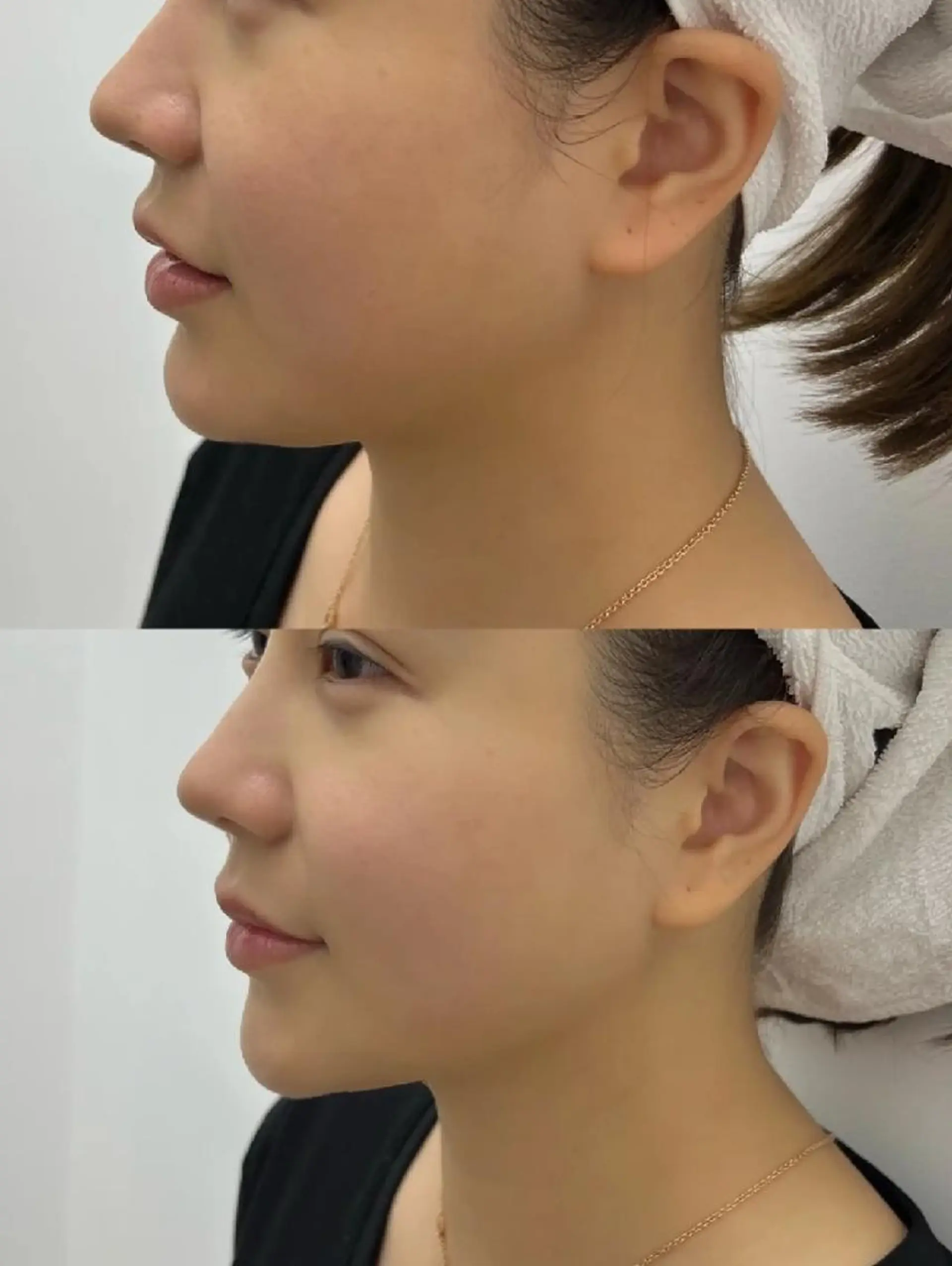 エステ aliaハーブ水光店 エステティシャン募集のエステ・リラクイメージ