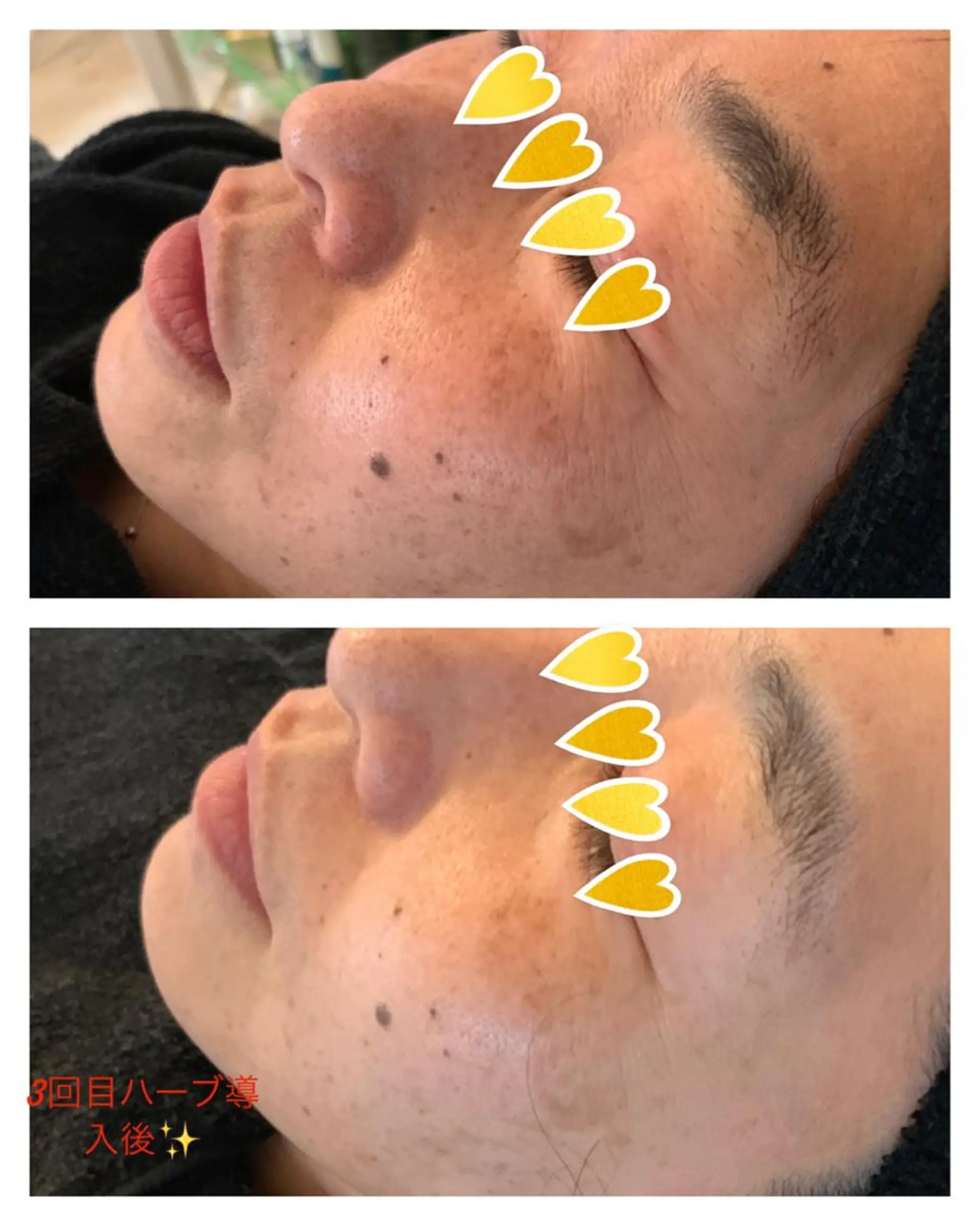 星 亜也加のネイルデザイン