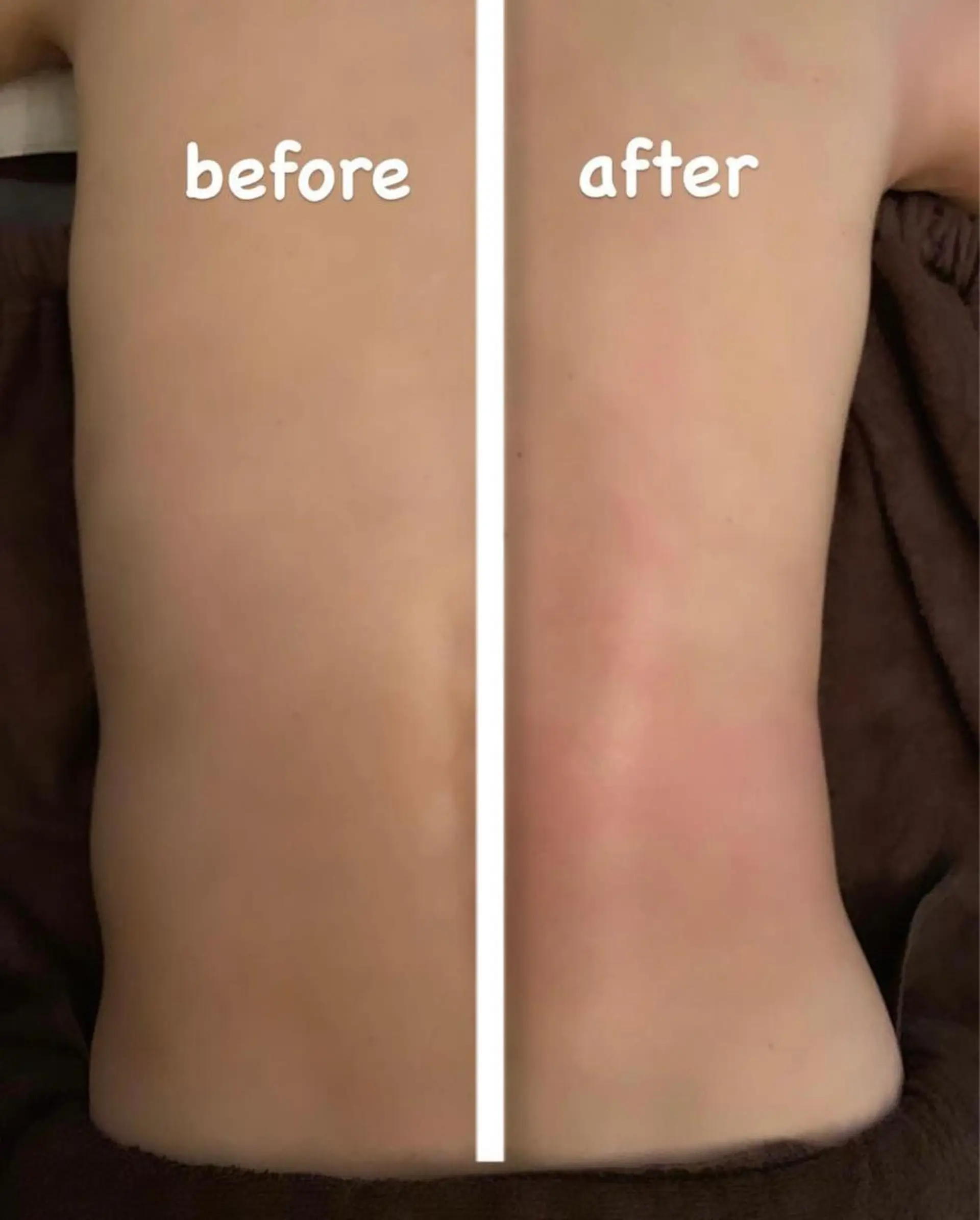 小顔・毛穴/ニキビ/ ハーブピーリング専門のエステ・リラクイメージ