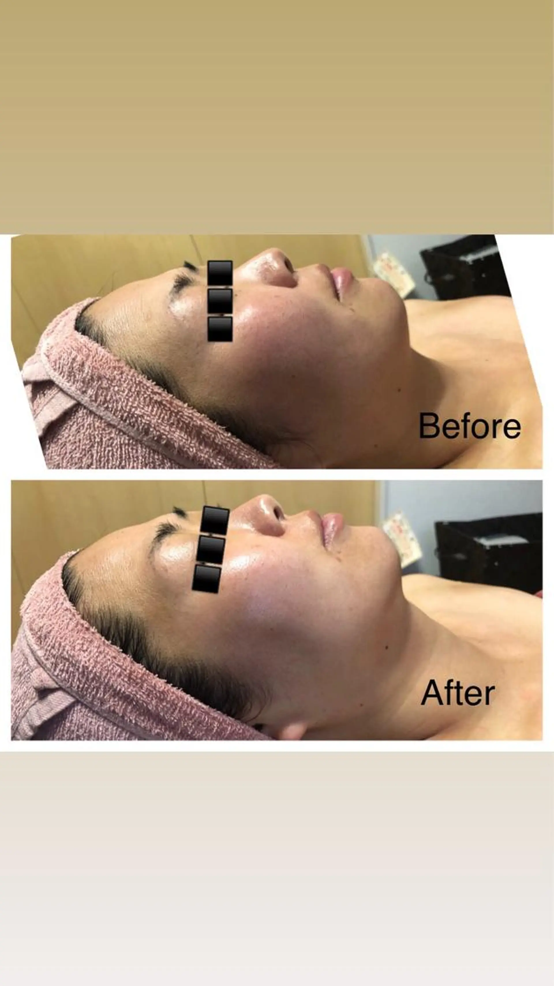 パラ・ ディのエステ・リラクイメージ