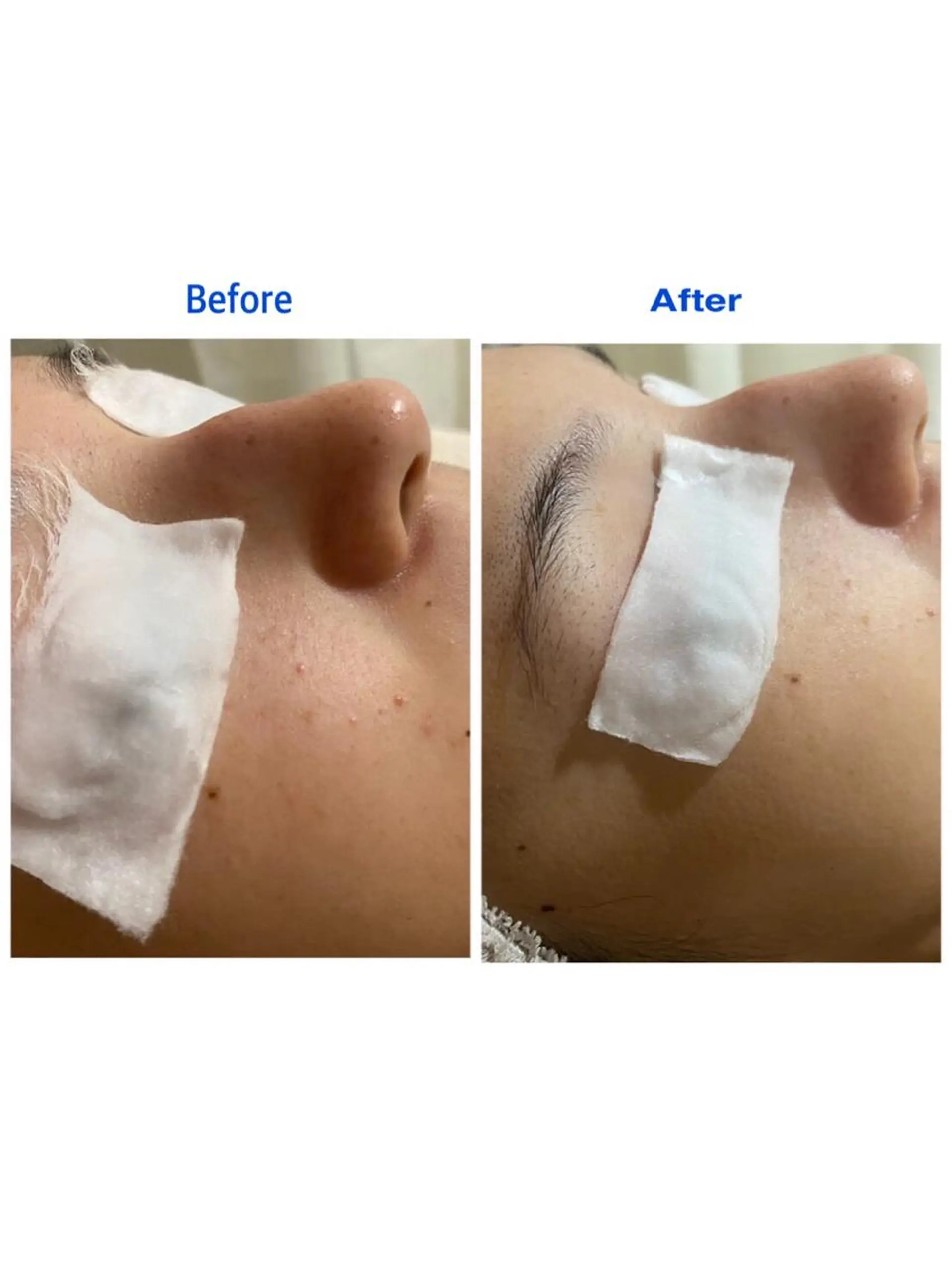 ポアレスサロン フィルのエステ・リラクイメージ