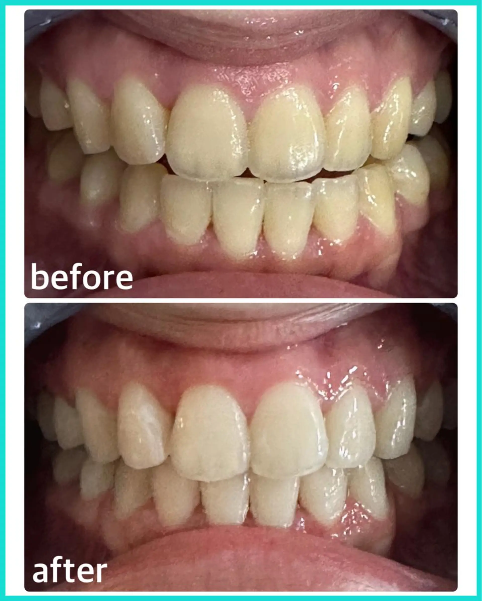 ホワイトニングサロン ラウレアのその他イメージ