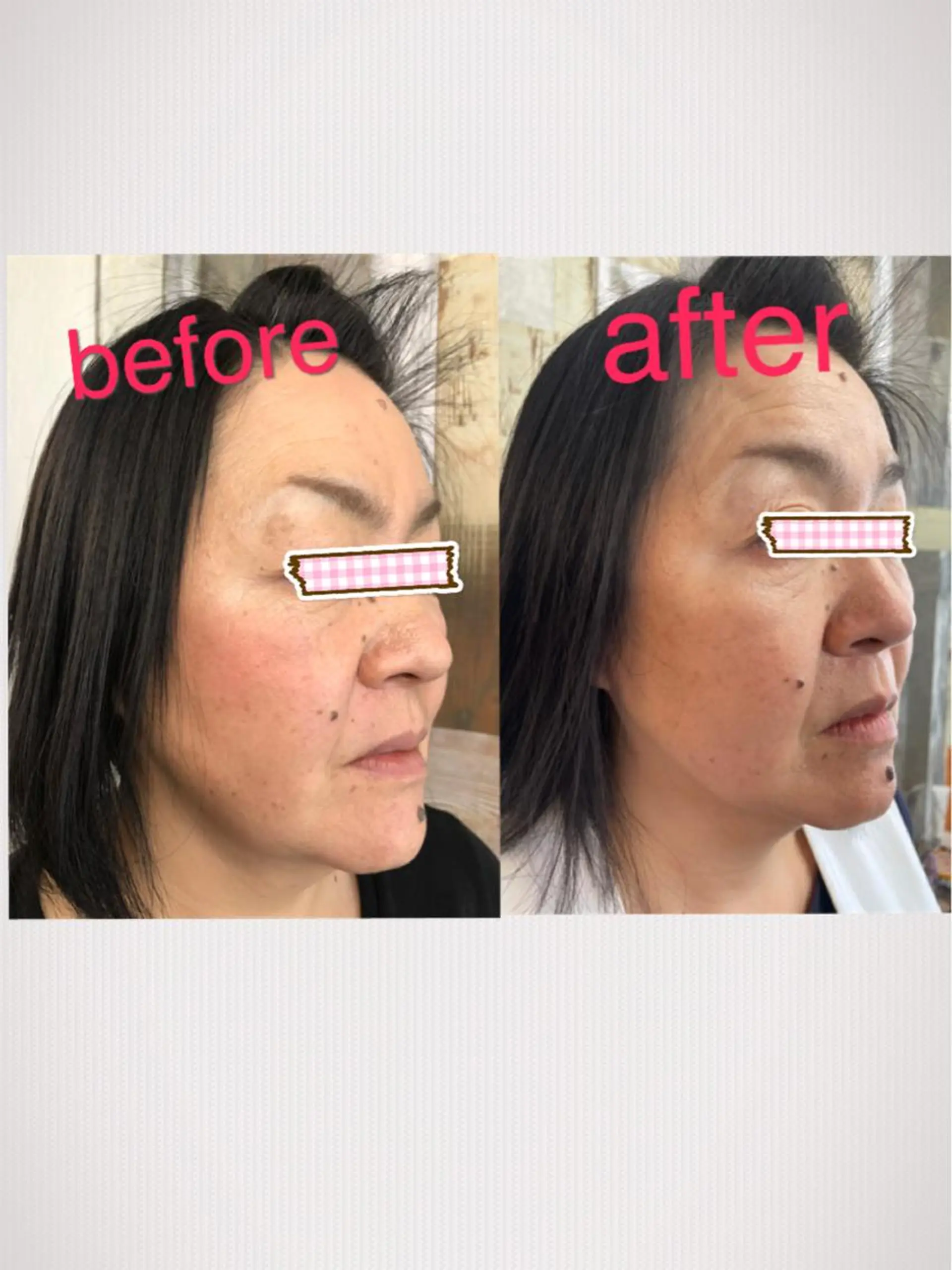 美と癒しのお店OTOHA 2nd所属・OTOHA 2nd ：yanoのエステ・リラクイメージ