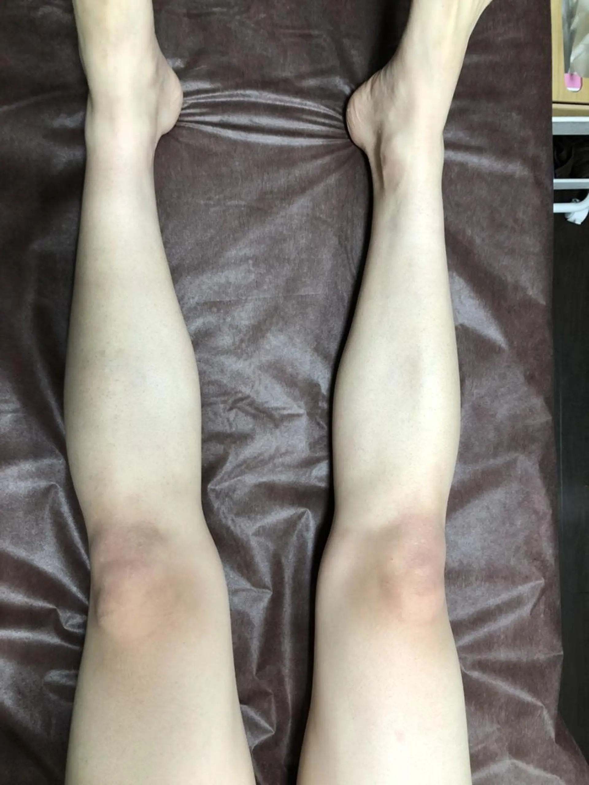 メンズ メンズ脱毛サロン REVERSEのエステ・リラクイメージ