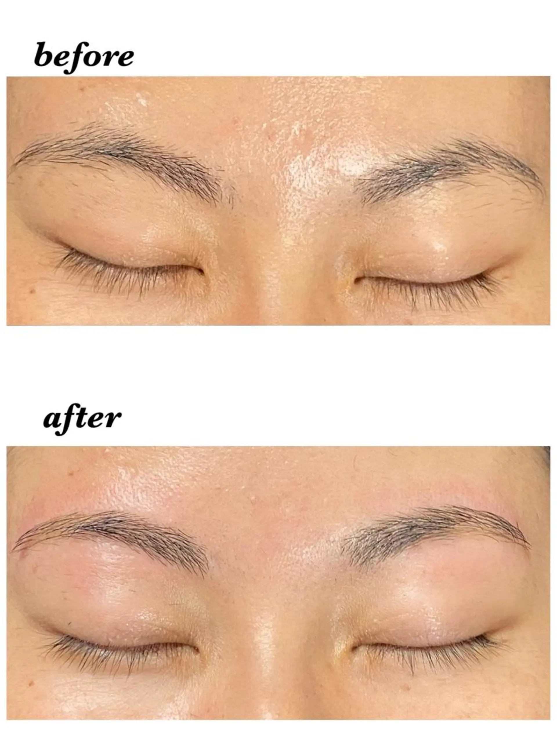 アイブロウ ハーブピーリング/韓国肌管理/フェイシャル/毛穴洗浄/眉毛/顔脱毛【糸脱毛専門】rev所属・ハーブピーリング専門 毛穴洗浄❤️眉waxのエステ・リラクイメージ