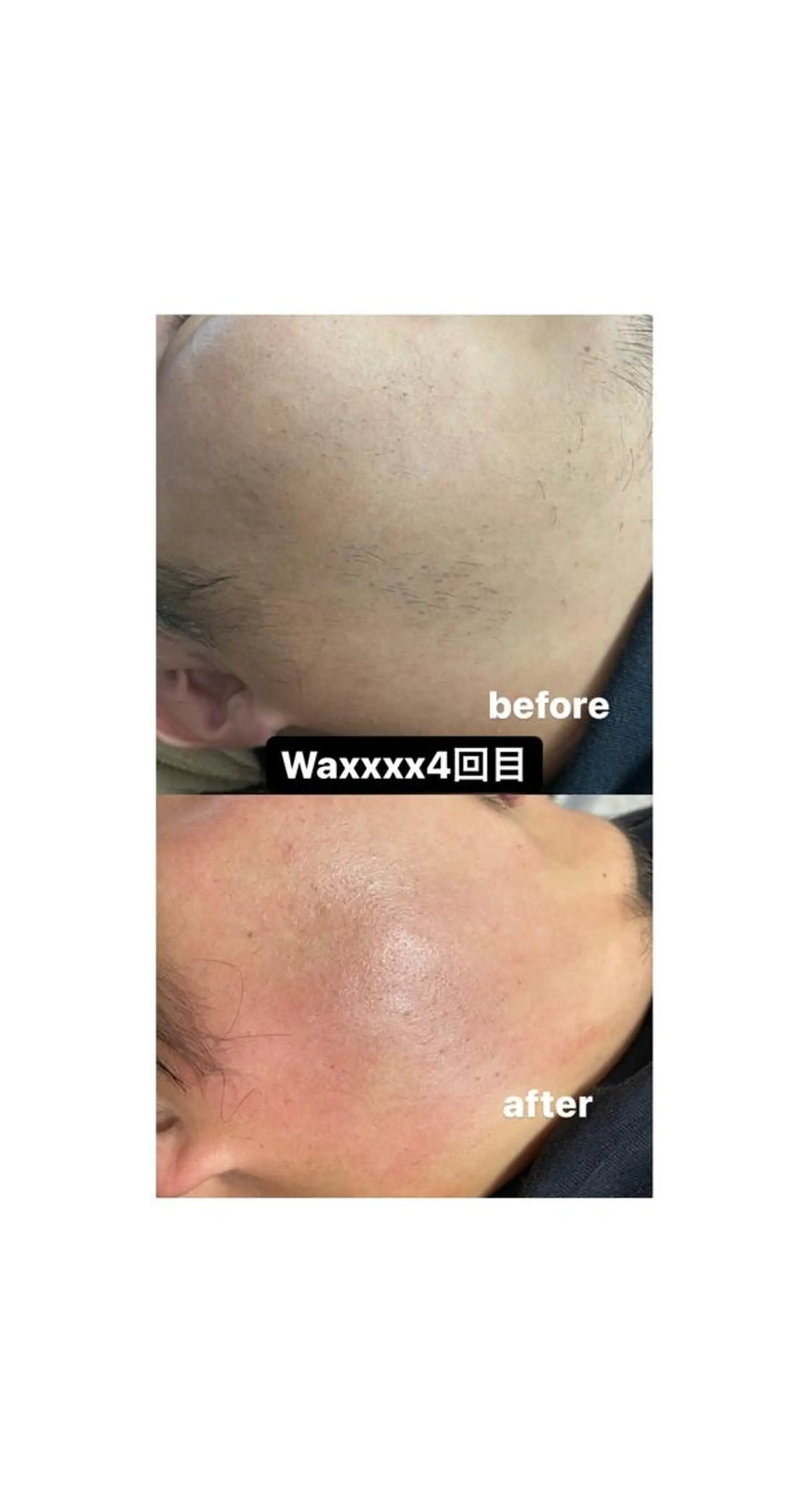 メンズ 脱毛 Epina 千葉店 【エピナ】のエステ・リラクイメージ