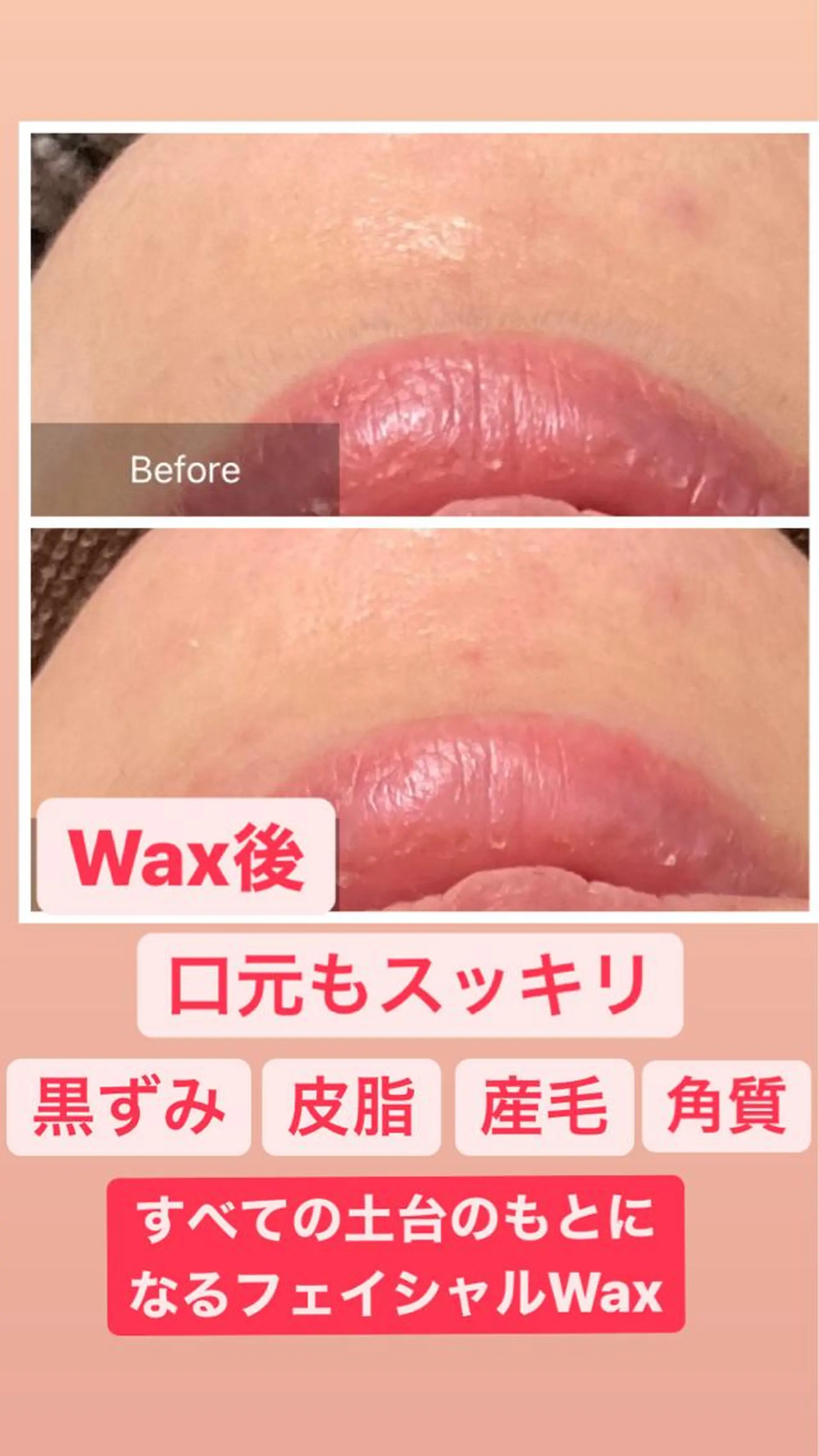 脱毛 産毛専門店 Bittoのエステ・リラクイメージ