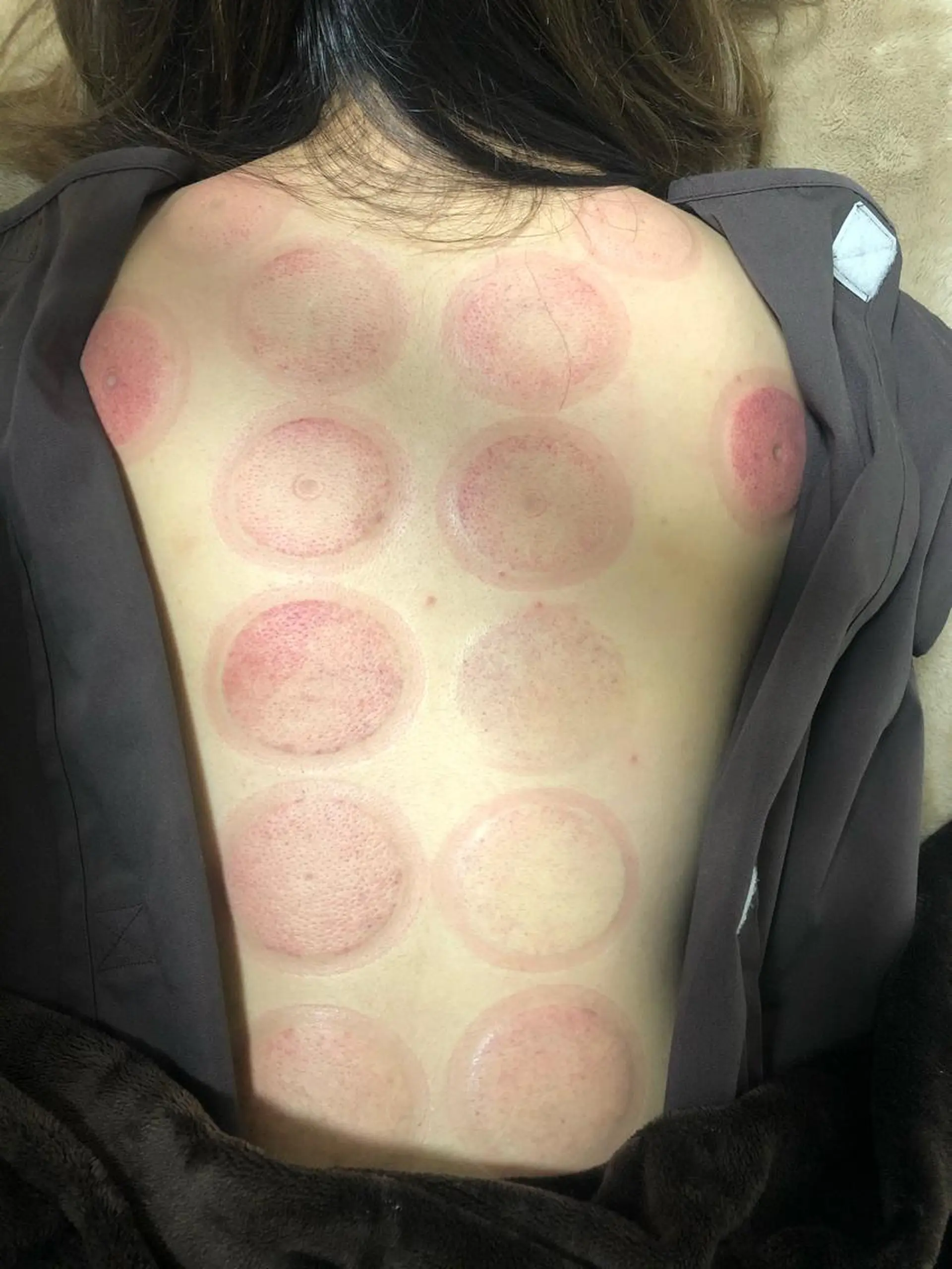 エステ リラク やはた鍼灸整骨院所属・やはた 鍼灸整骨院のエステ・リラクイメージ