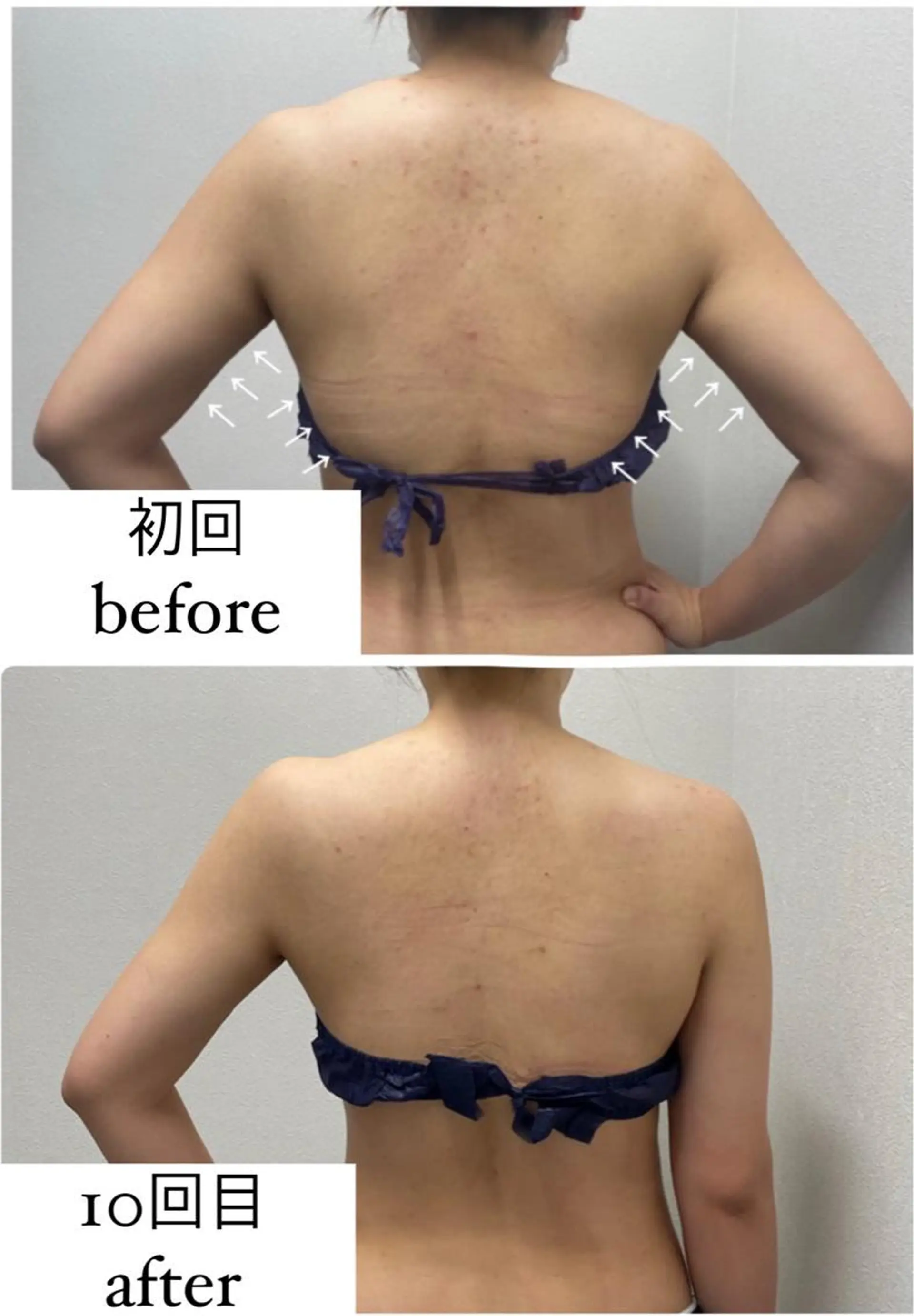 エステ ENCHANT 脱毛.小顔.毛穴のエステ・リラクイメージ