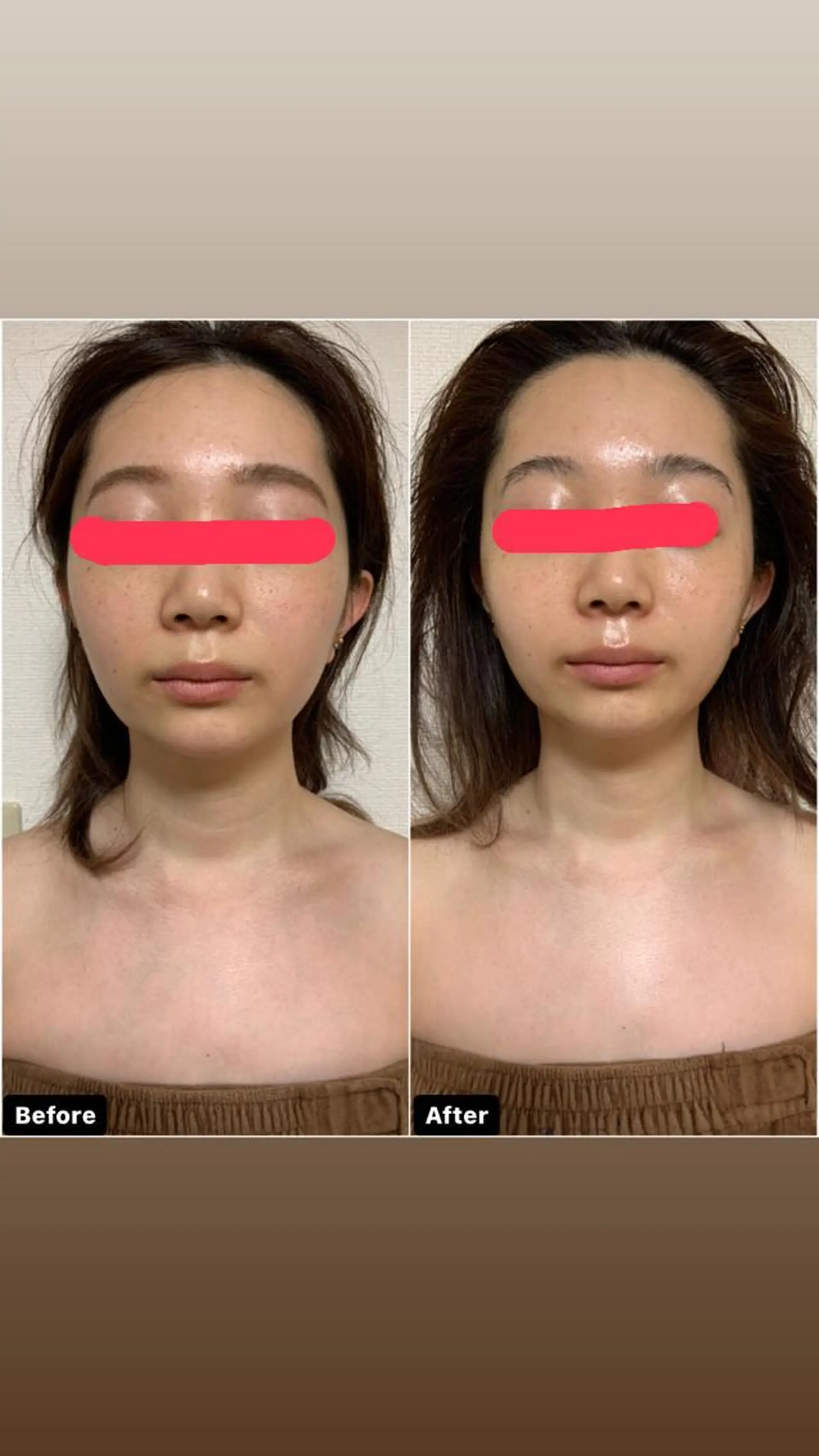 Linomalie エステ/たるみ/脱毛のエステ・リラクイメージ