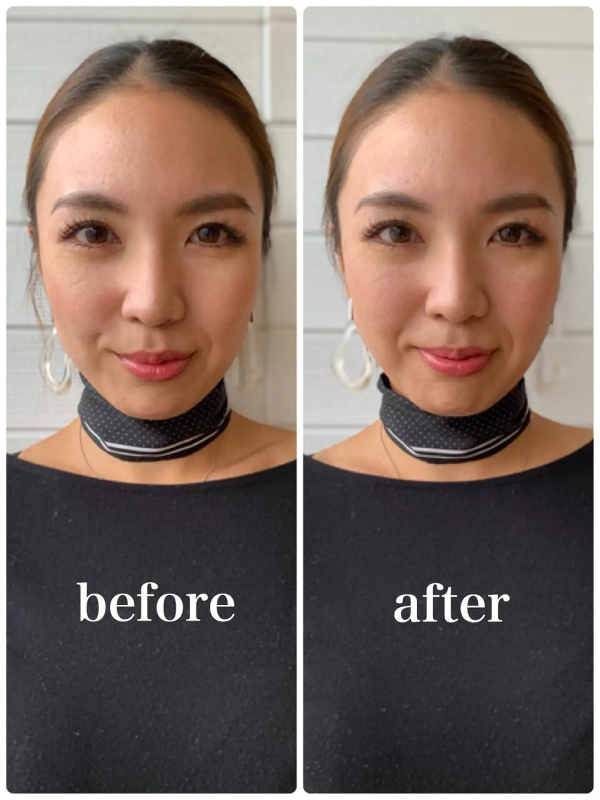 美容鍼 IKEZAKIのエステ・リラクイメージ