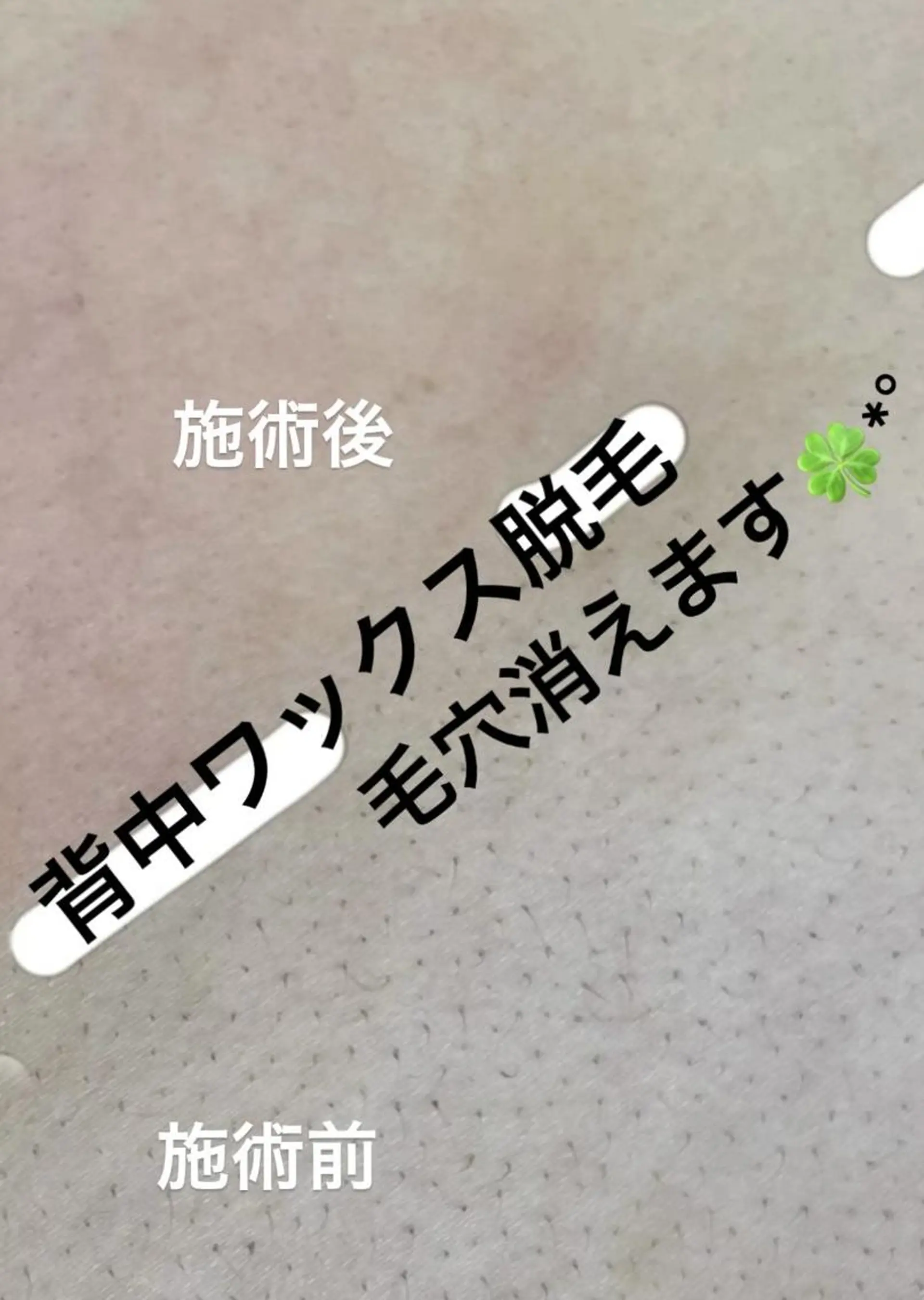 KIRAN 山﨑のエステ・リラクイメージ