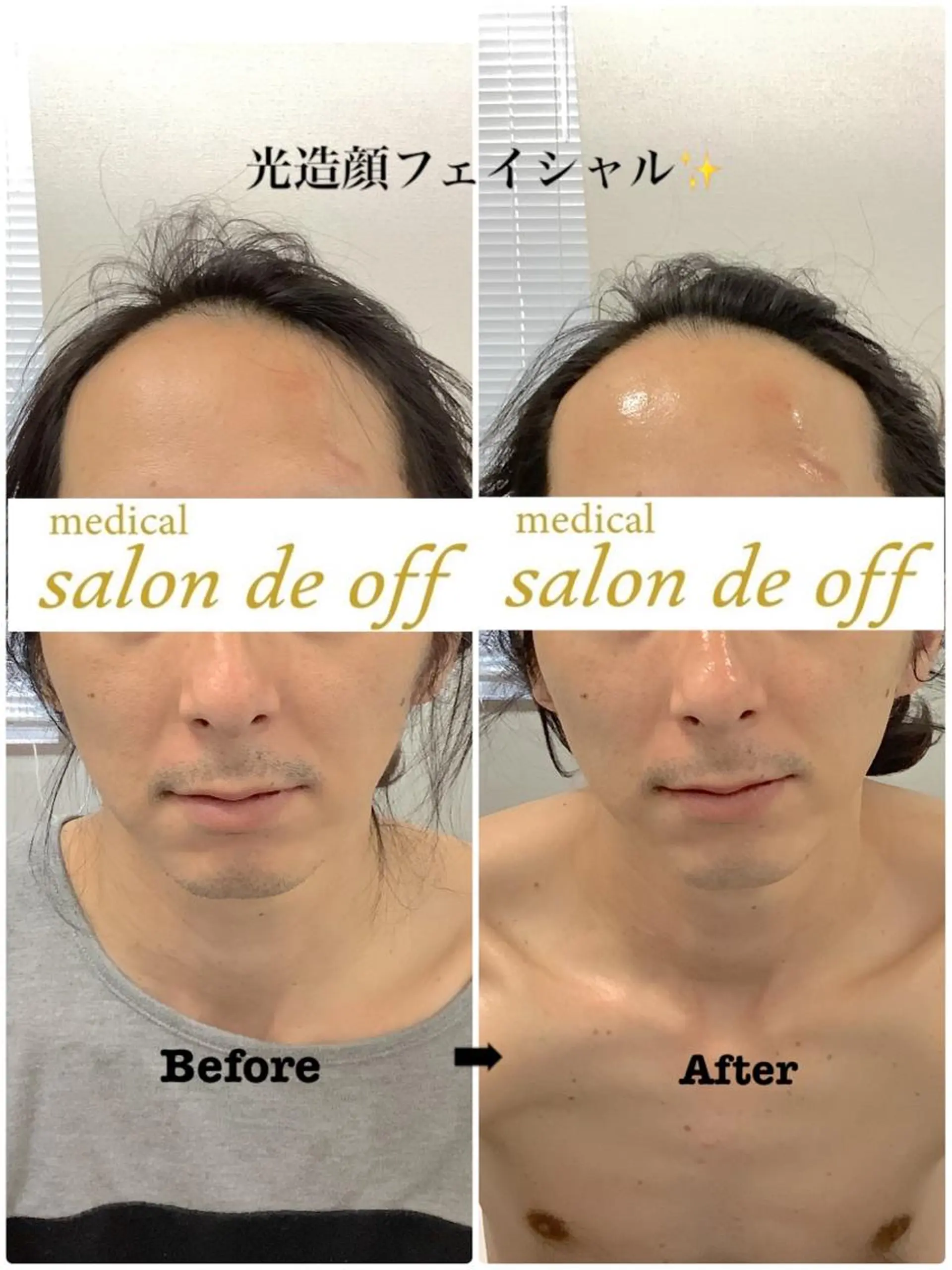 🩵Tatsumi Kana🩵のエステ・リラクイメージ