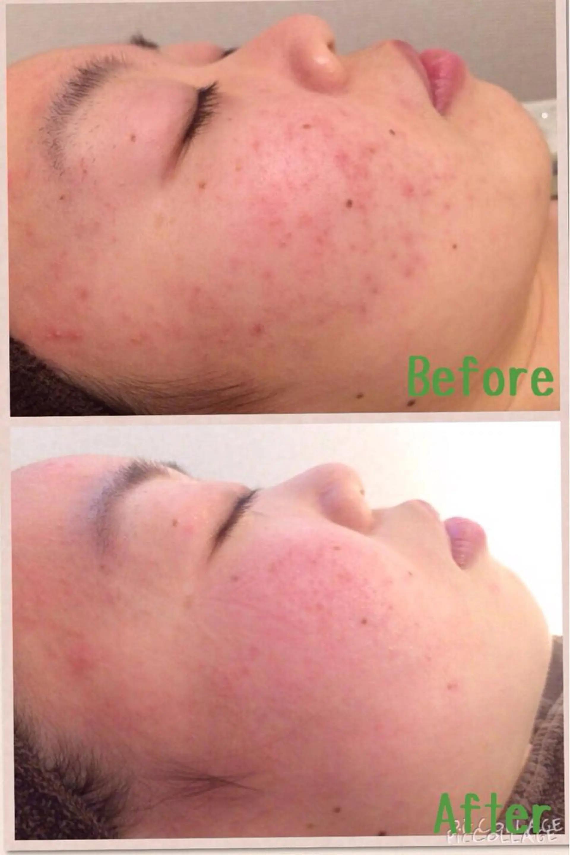 ロング カラー パーマ ヘアアレンジ メンズ キッズ ネイル マツエク・マツパ アニメ,Vオタク× 即効痩せエステサロンのエステ・リラクイメージ